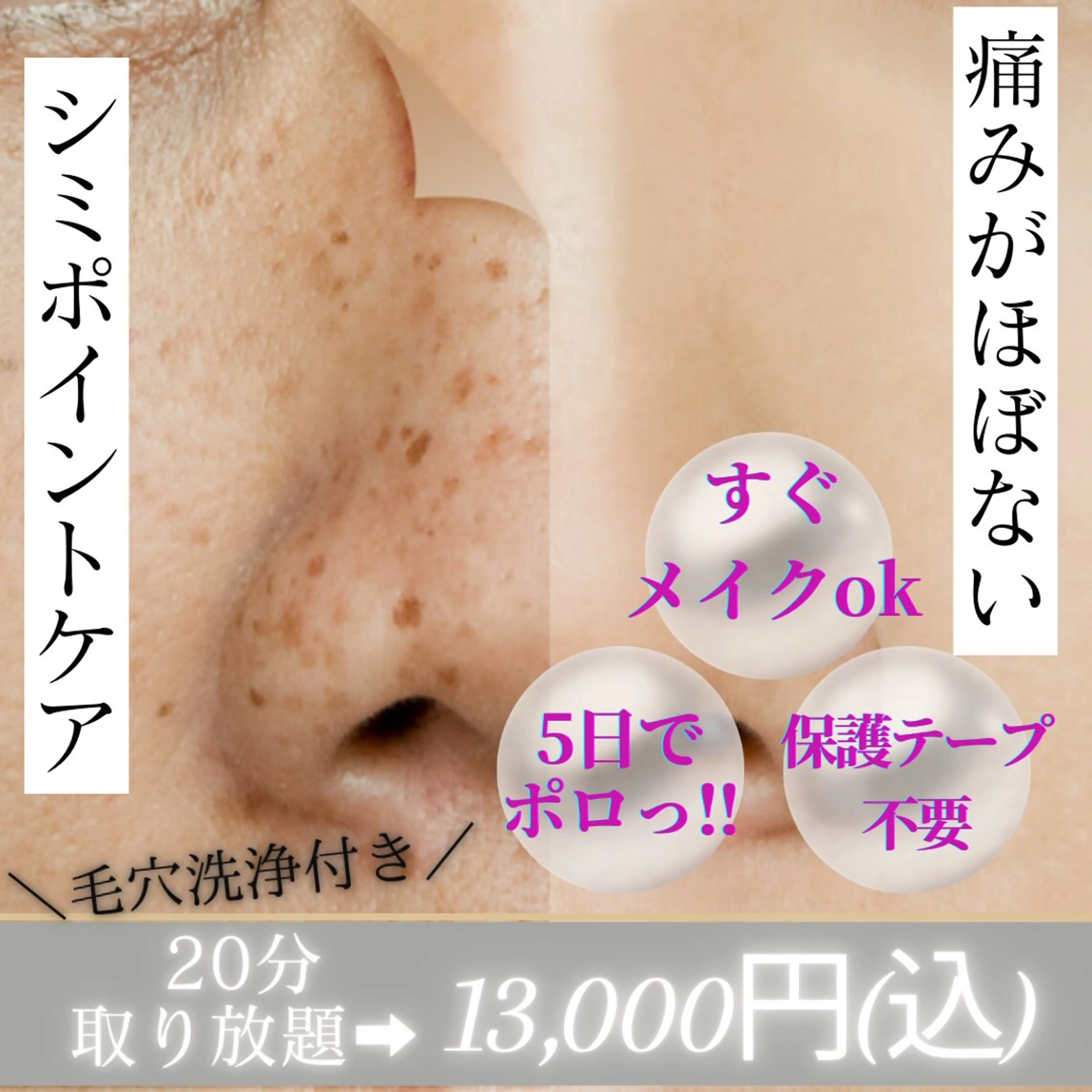 【多めの方に◎】シミ集中ケア/毛穴洗浄×20分取り放題(20~40個程)約45分の写真