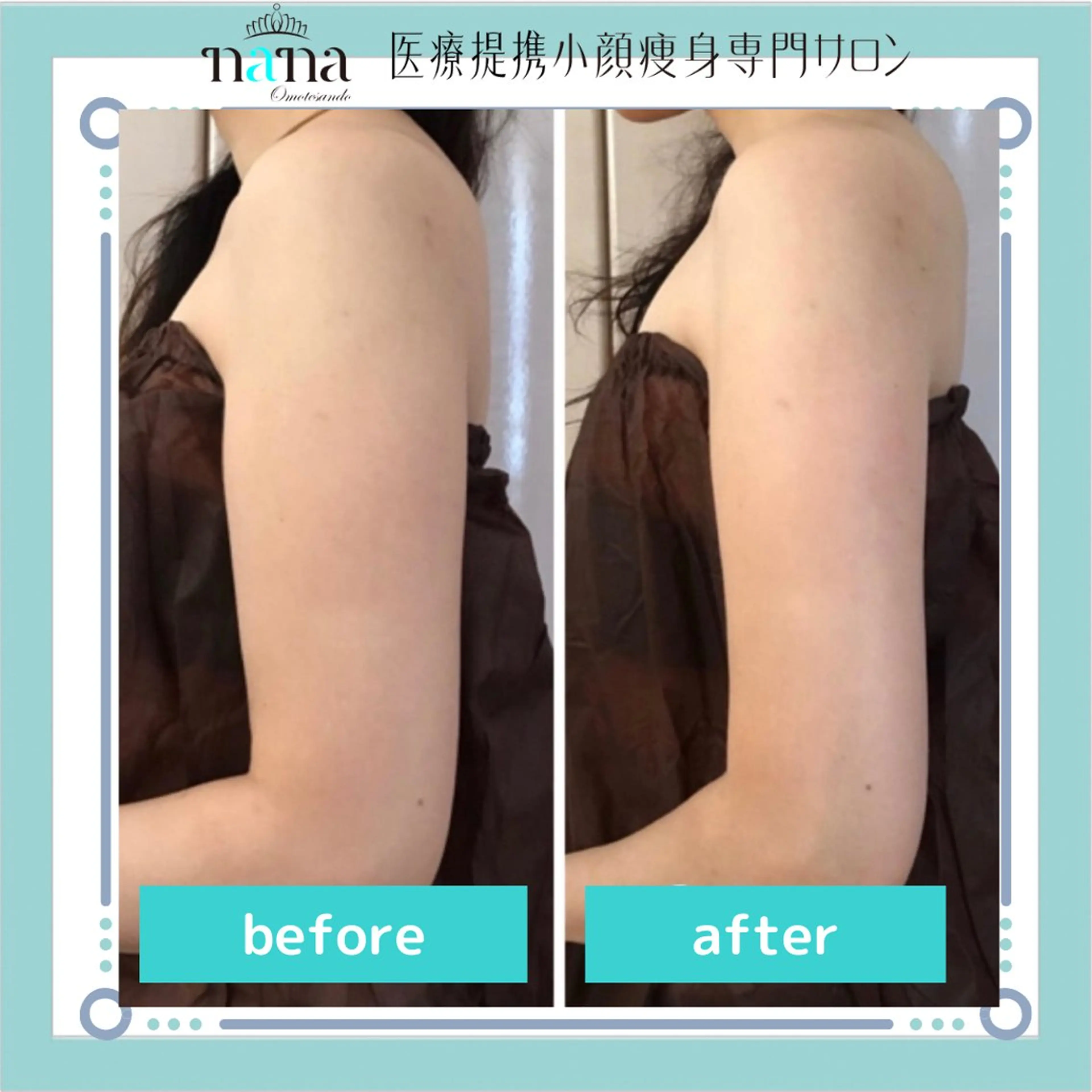 小顔痩身インディバ Nana表参道のエステ・リラクイメージ