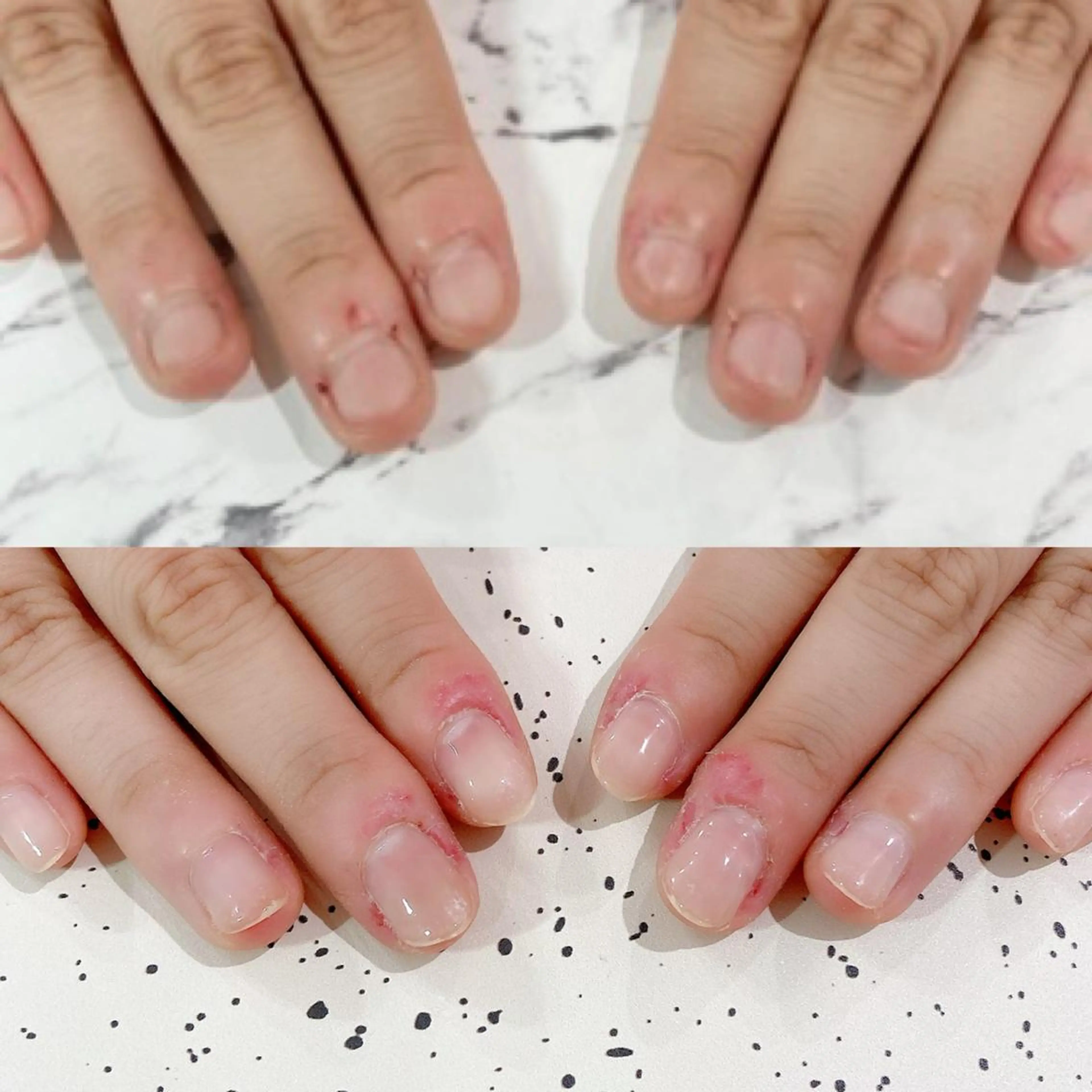 ネイル クリアネイル ジェルネイル パラジェル ピンク シンプルネイル ハンドネイル Nail Kのネイルデザイン