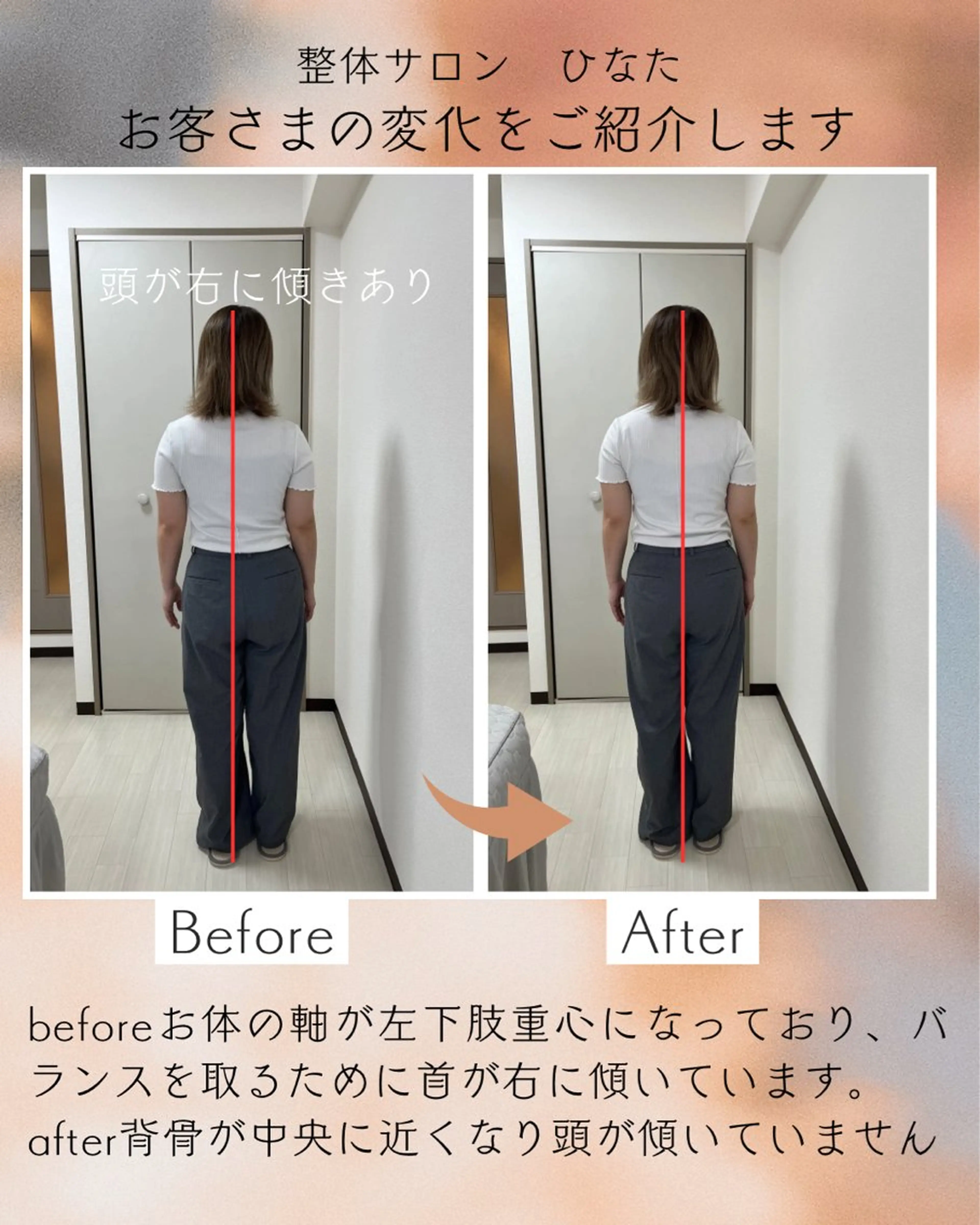 整体サロン　ひなた~HINATA~ 　京阪七条　京都店所属・肩こり反り腰改善専門 筋膜✨整体ひなたのエステ・リラクイメージ