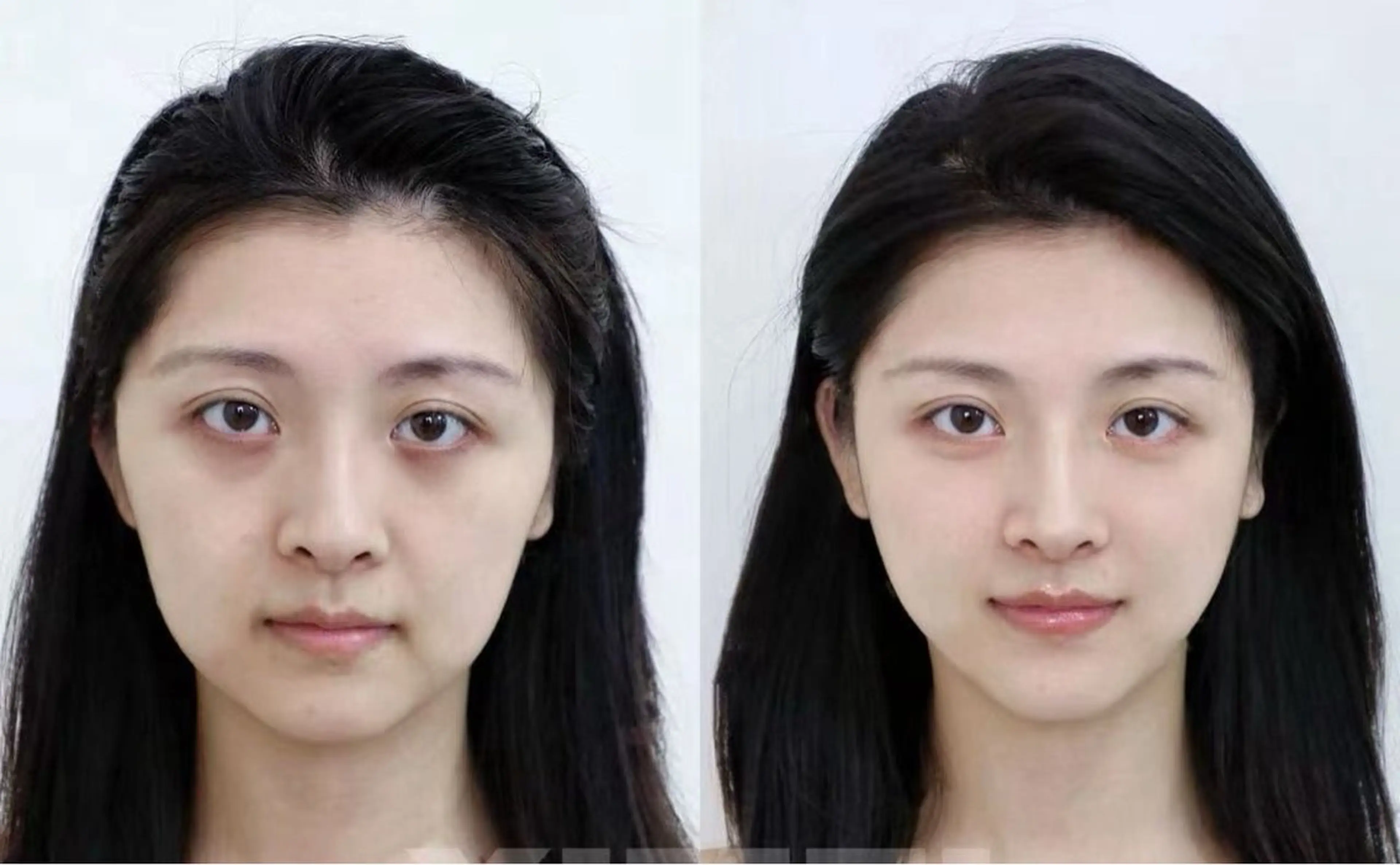 ショート エステ aliaハイフ&水光ジェットサロン所属・aliaハーブ水光店 エステティシャン募集のエステ・リラクイメージ