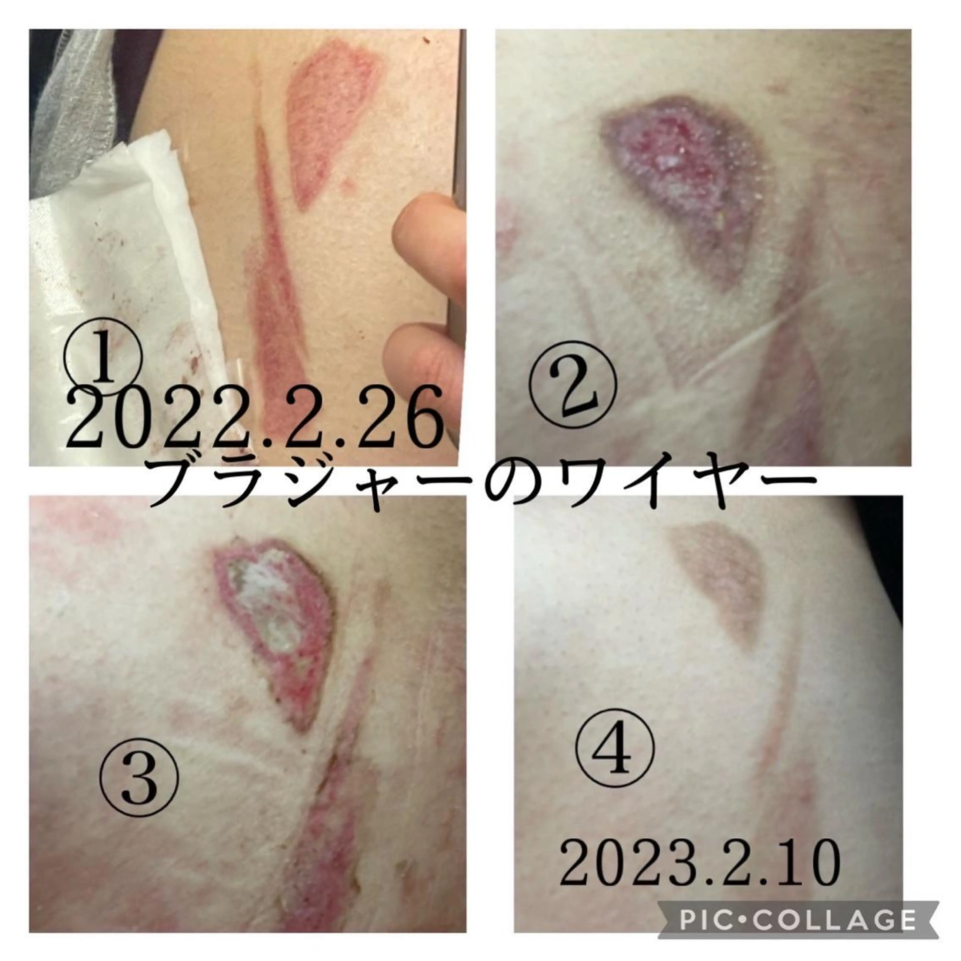 private salon Dea_maris シュガーリング&パーソナルボディケア所属・シミ改善・韓国肌管理 ボディメイク痩身のその他イメージ