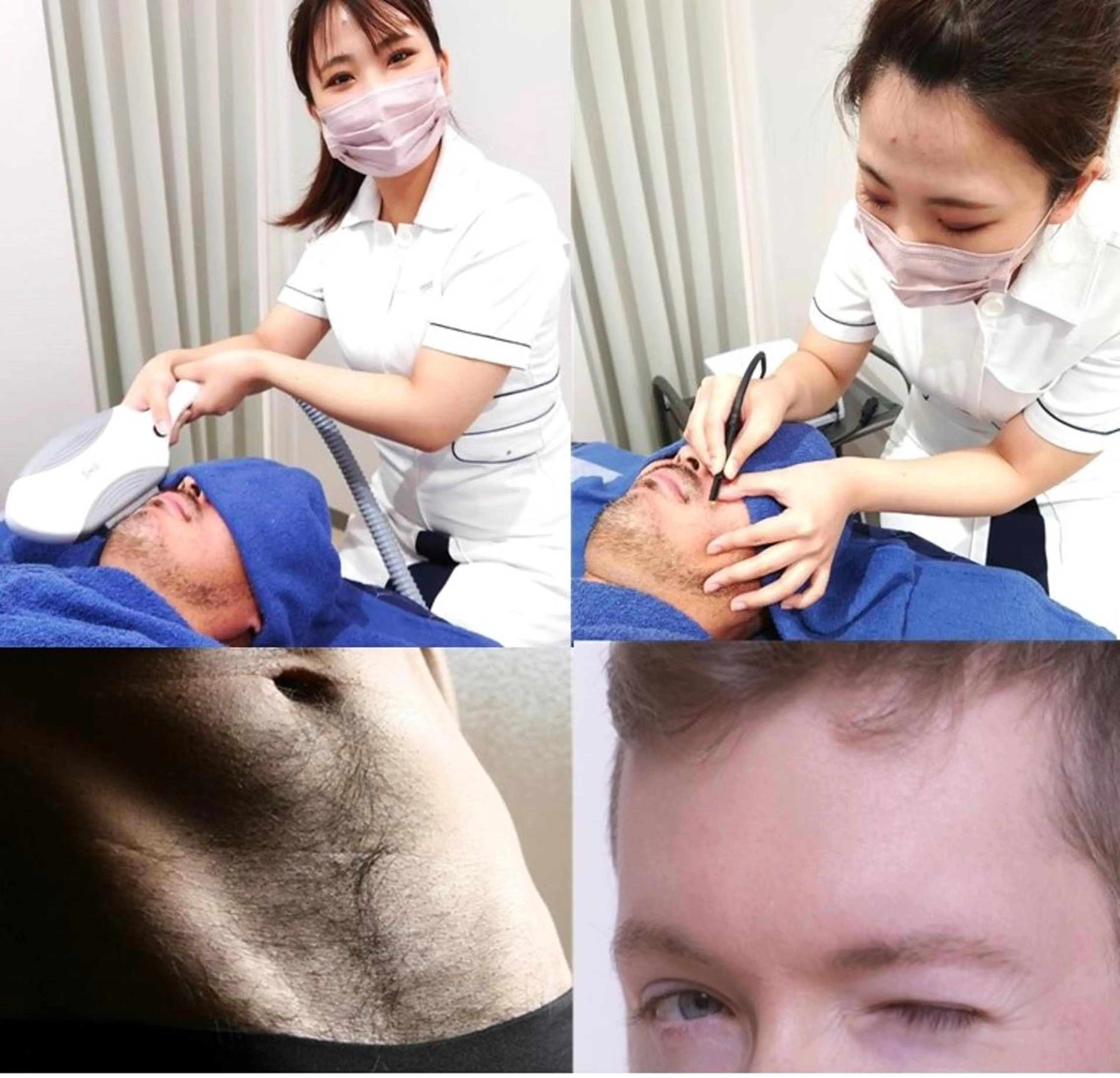 【メンズ脱毛】男磨き三種各¥999→VIOor髭脱毛or美眉毛(デザイン料込★)の写真