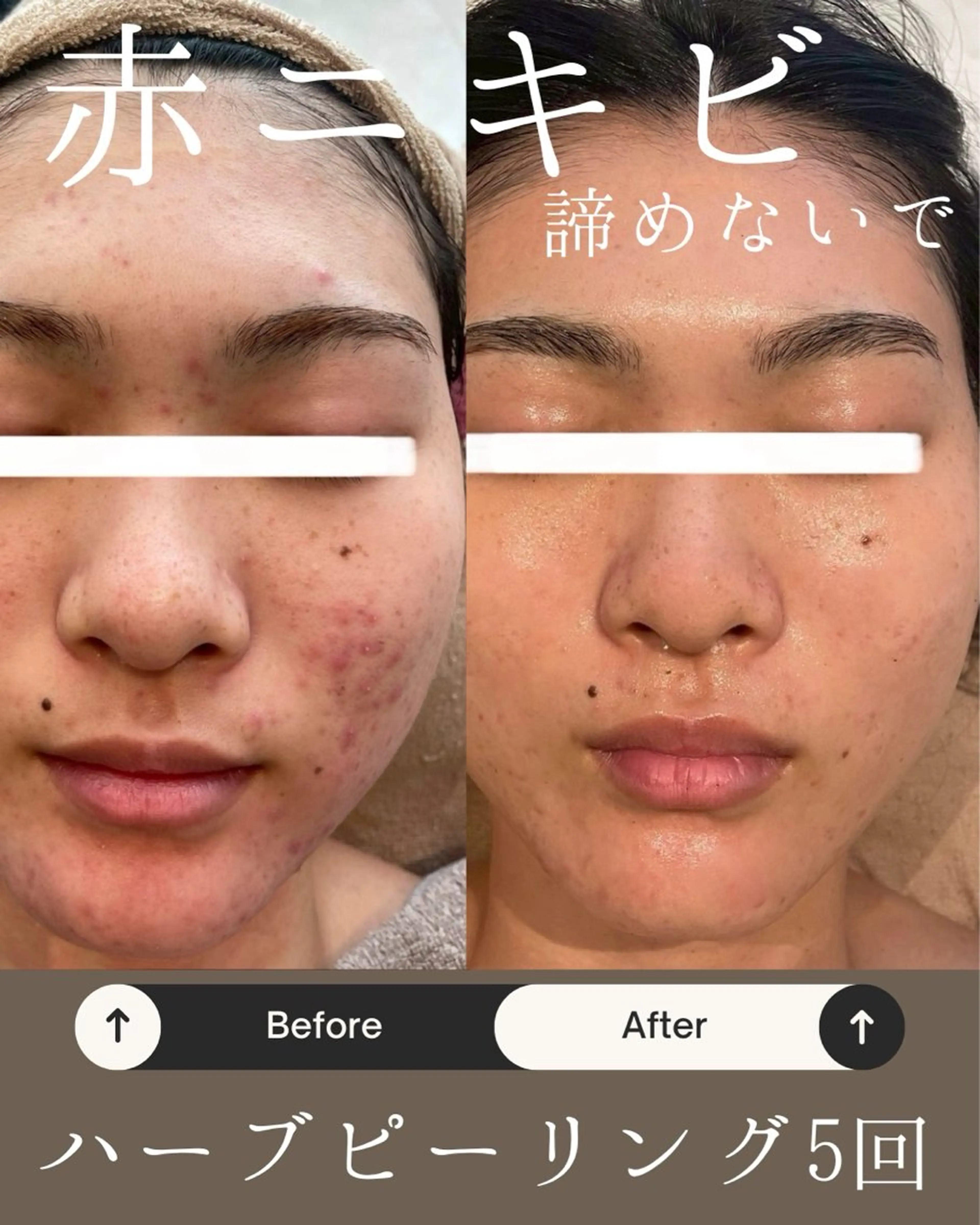 エステ Anpawman所属・Anpawman アンパウマンのエステ・リラクイメージ