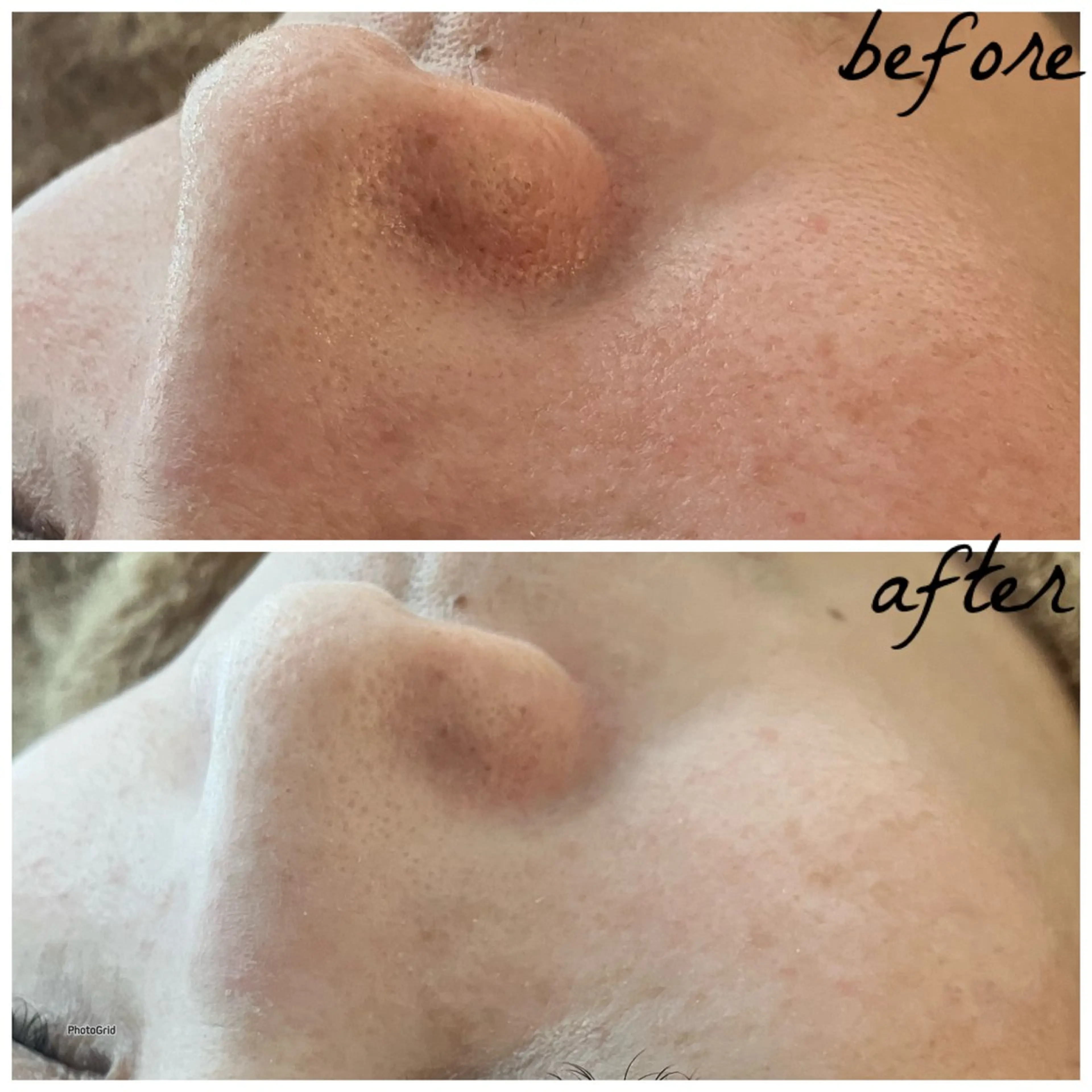 メンズ メナード岐阜茜部 杉浦のエステ・リラクイメージ