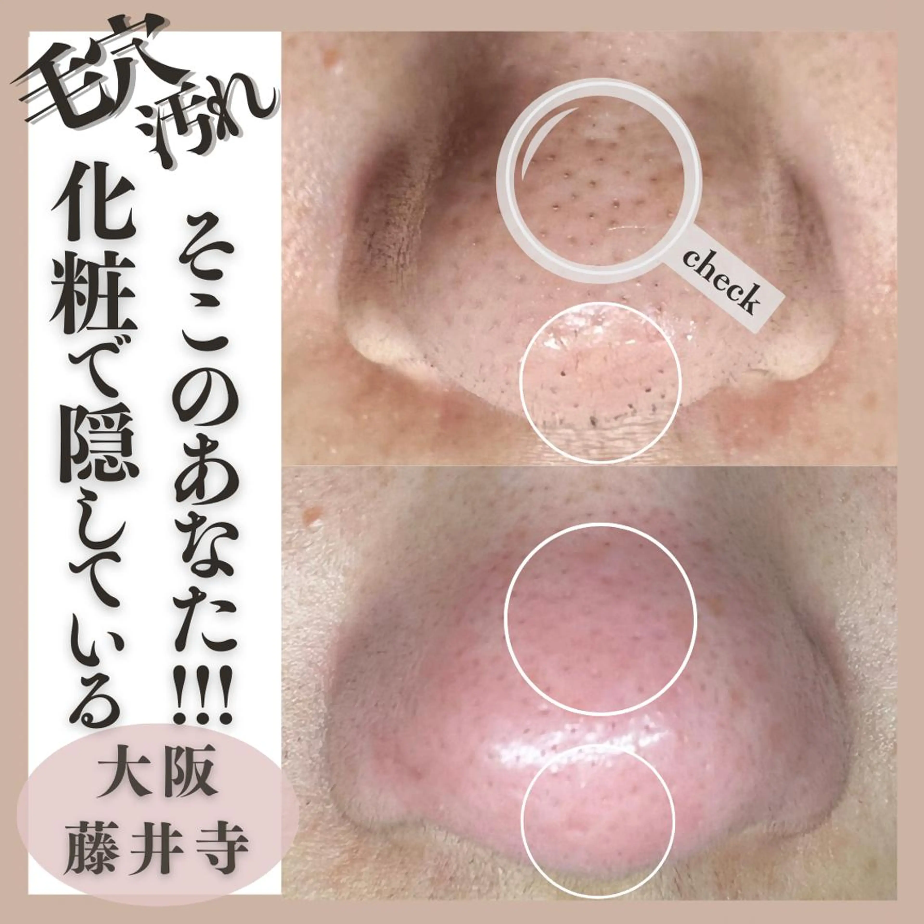 Muqu.所属・Muqu. 毛穴サロンのエステ・リラクイメージ