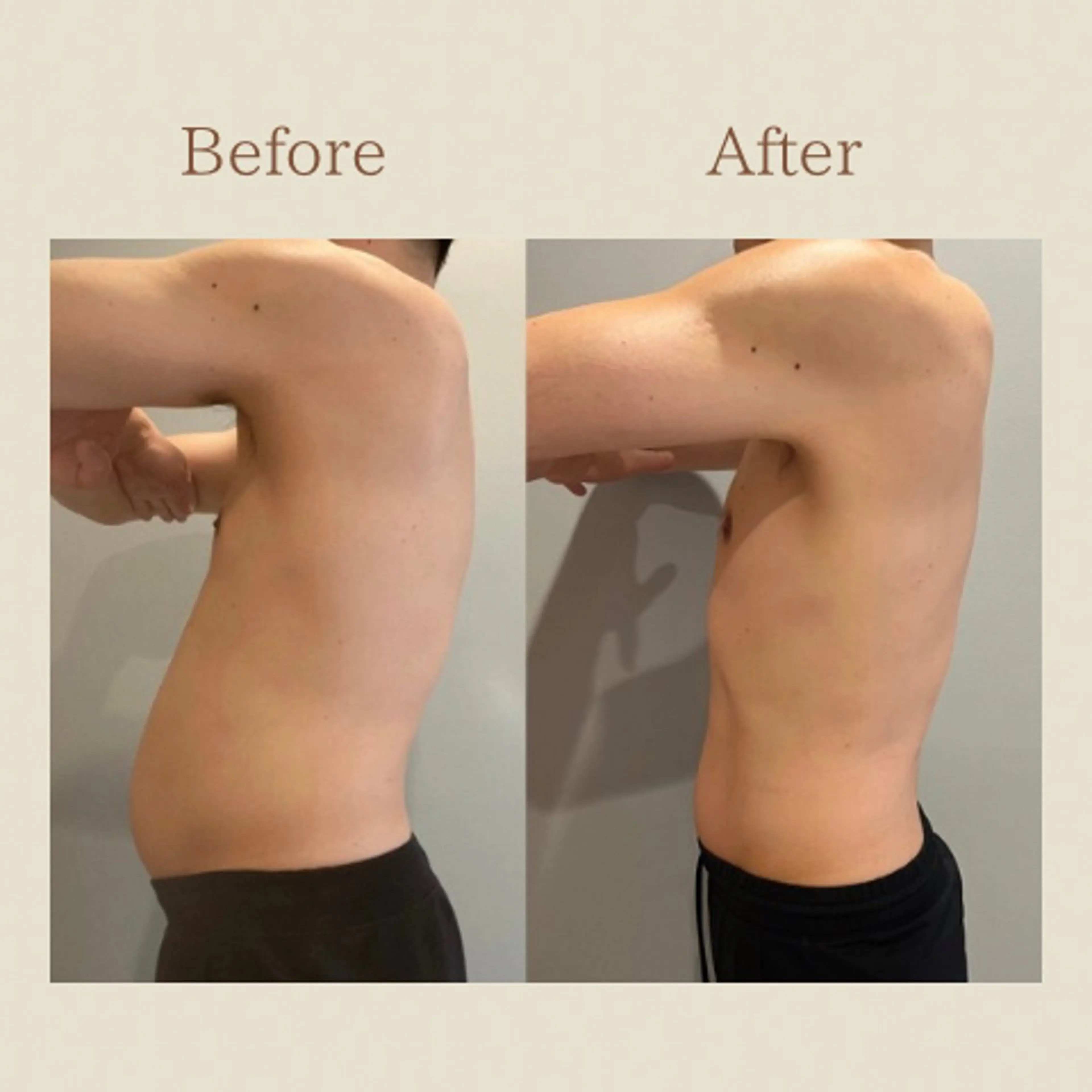 お腹痩せエステ Flat BELLY 恵比寿所属・【腸もみ/脂肪冷却】 お腹エステ/恵比寿のエステ・リラクイメージ