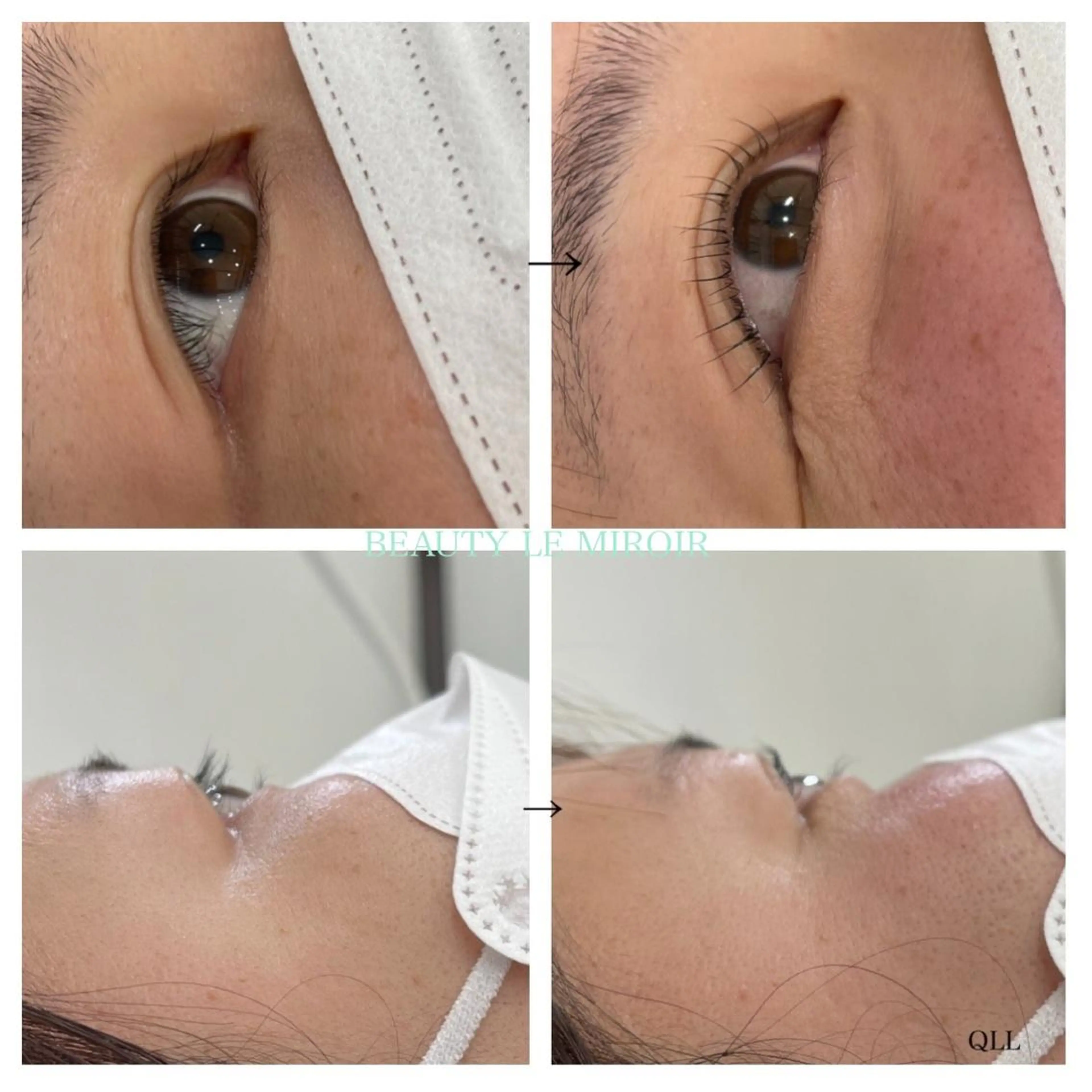 マツエク・マツパ ビューティー ミロワールのエステ・リラクイメージ