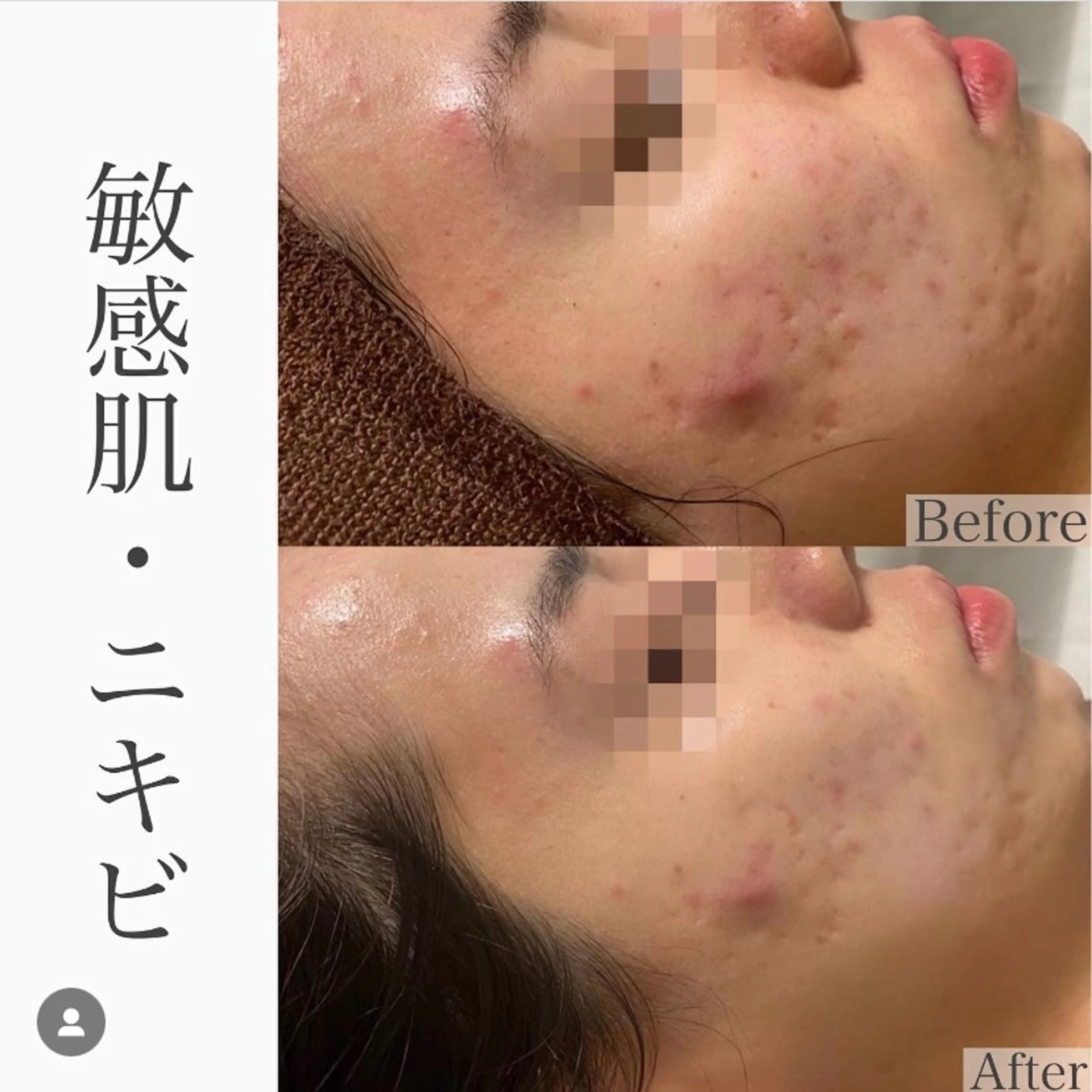 ハーブピーリング専門 BIOEL横浜のエステ・リラクイメージ