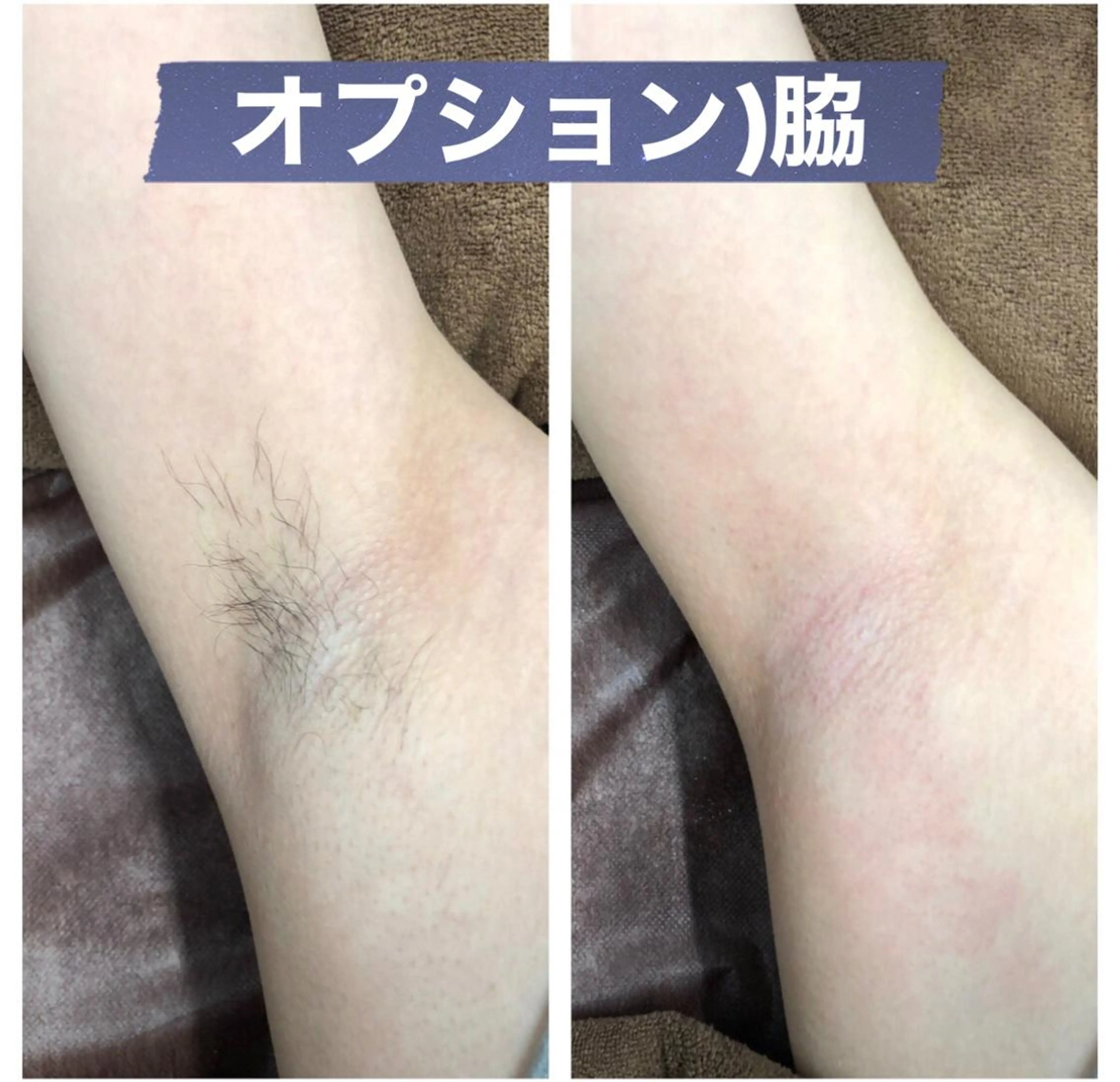 脱毛 ブラジリアン☆WAX 🎖🌚YUKI🌚のエステ・リラクイメージ