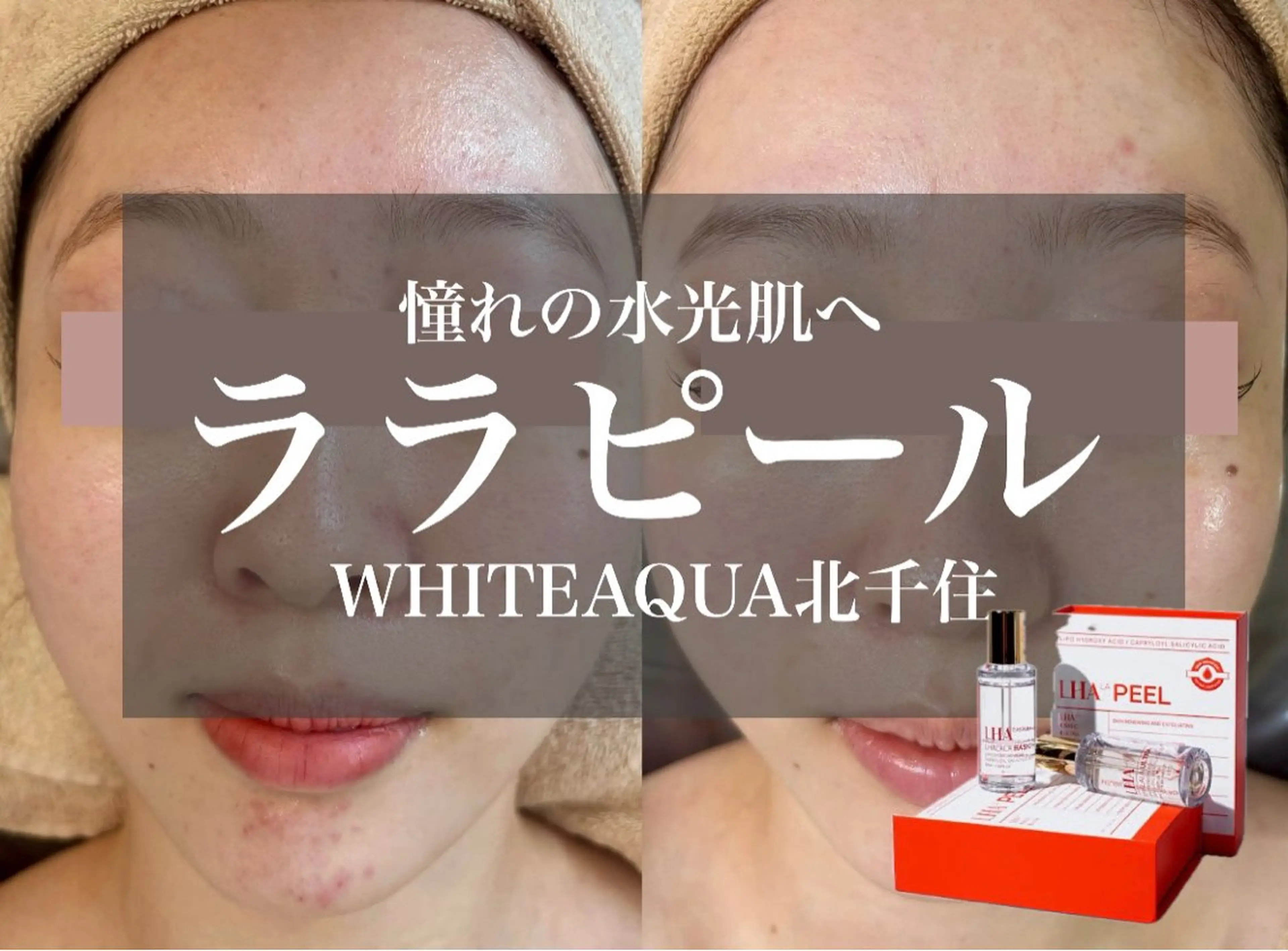 エステ WHITE AQUA 北千住店のエステ・リラクイメージ