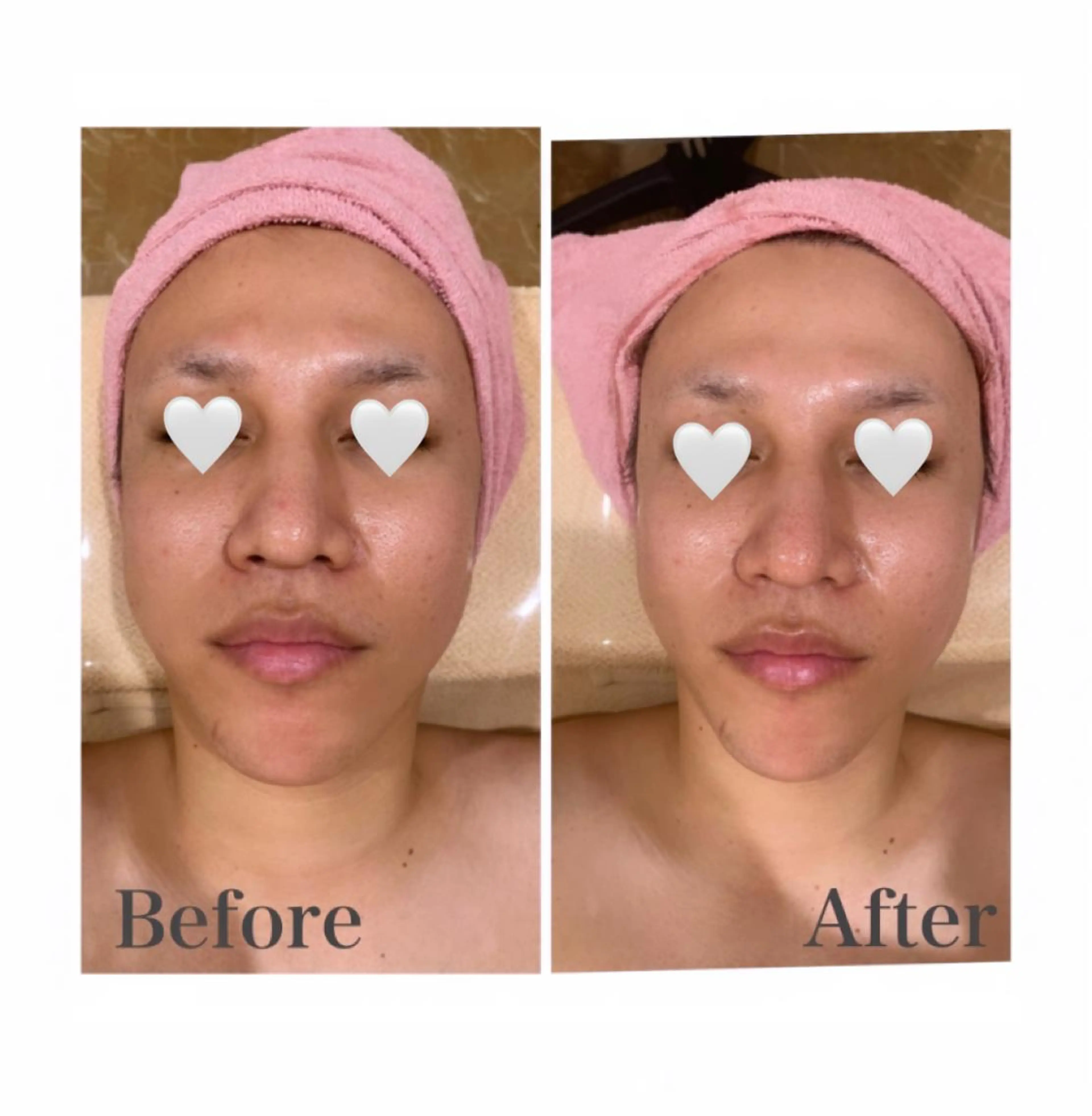 フェイシャル/脱毛 ジョアアンジェ　田中のエステ・リラクイメージ