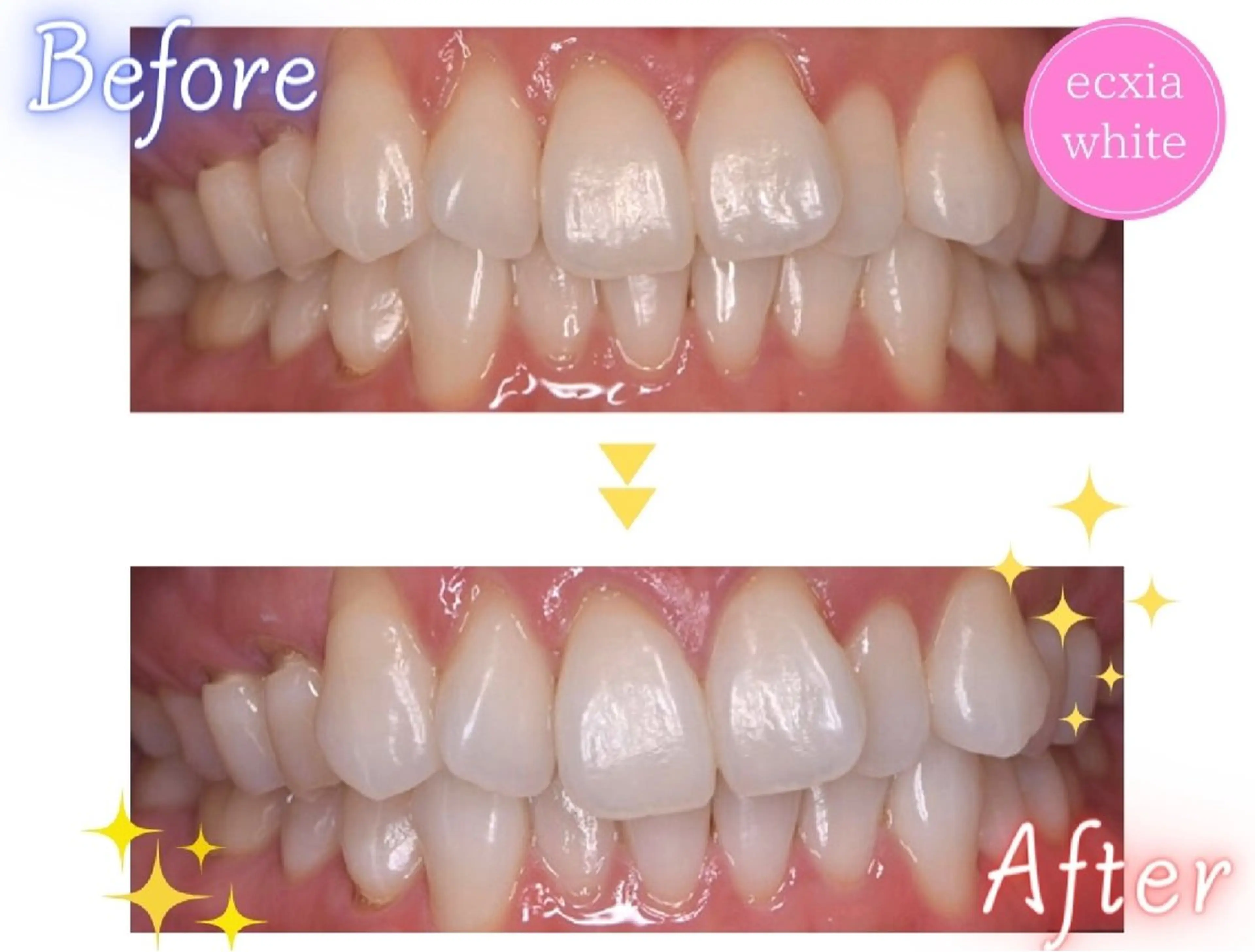 その他 エクシアホワイト エミフルMASAKIのその他イメージ