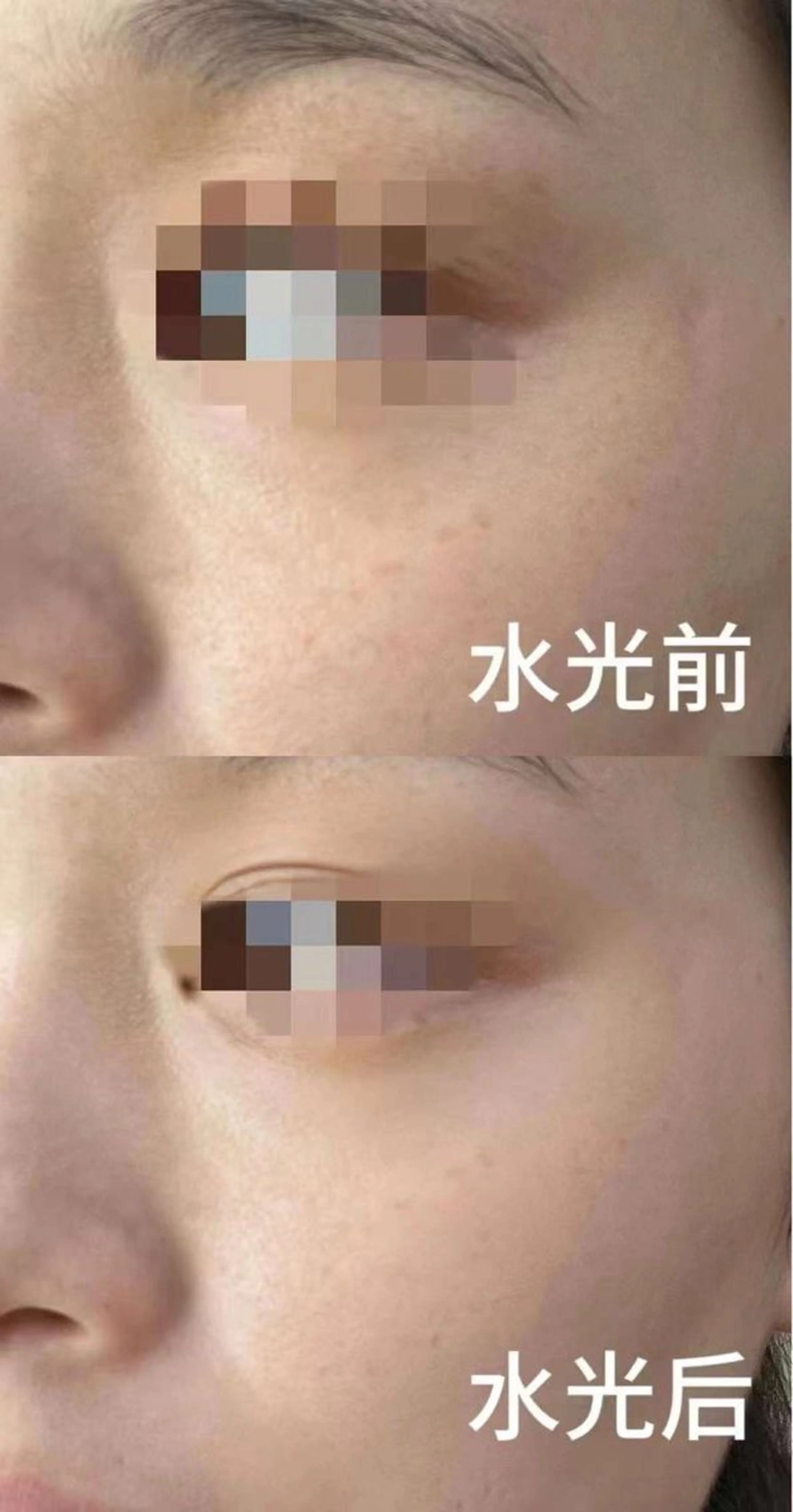 マツエク・マツパ エステ aliaハイフ&水光ジェットサロン所属・aliaハーブ水光店 エステティシャン募集のエステ・リラクイメージ