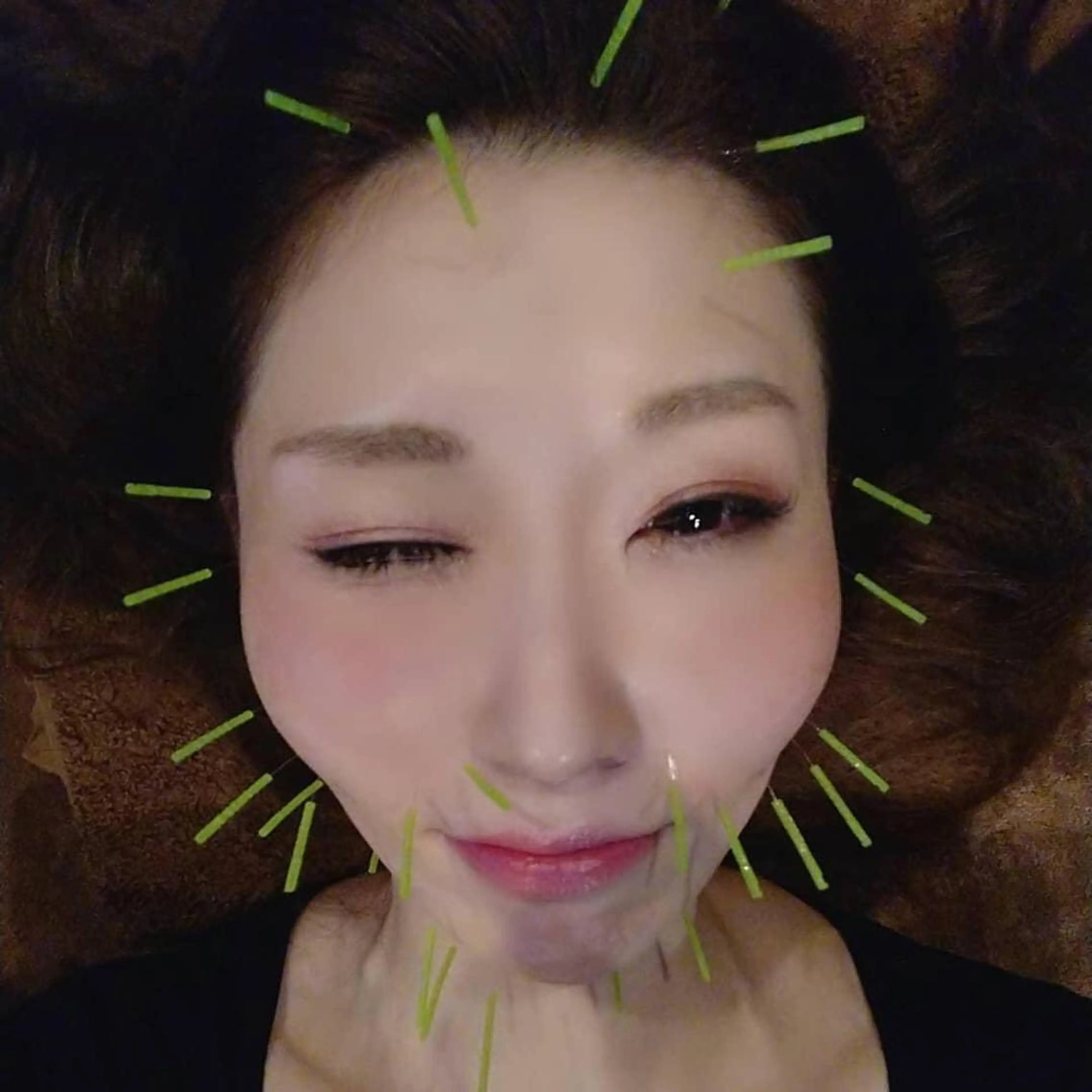 エステ リラク 美容鍼灸サロン LOMIHARIのエステ・リラクイメージ