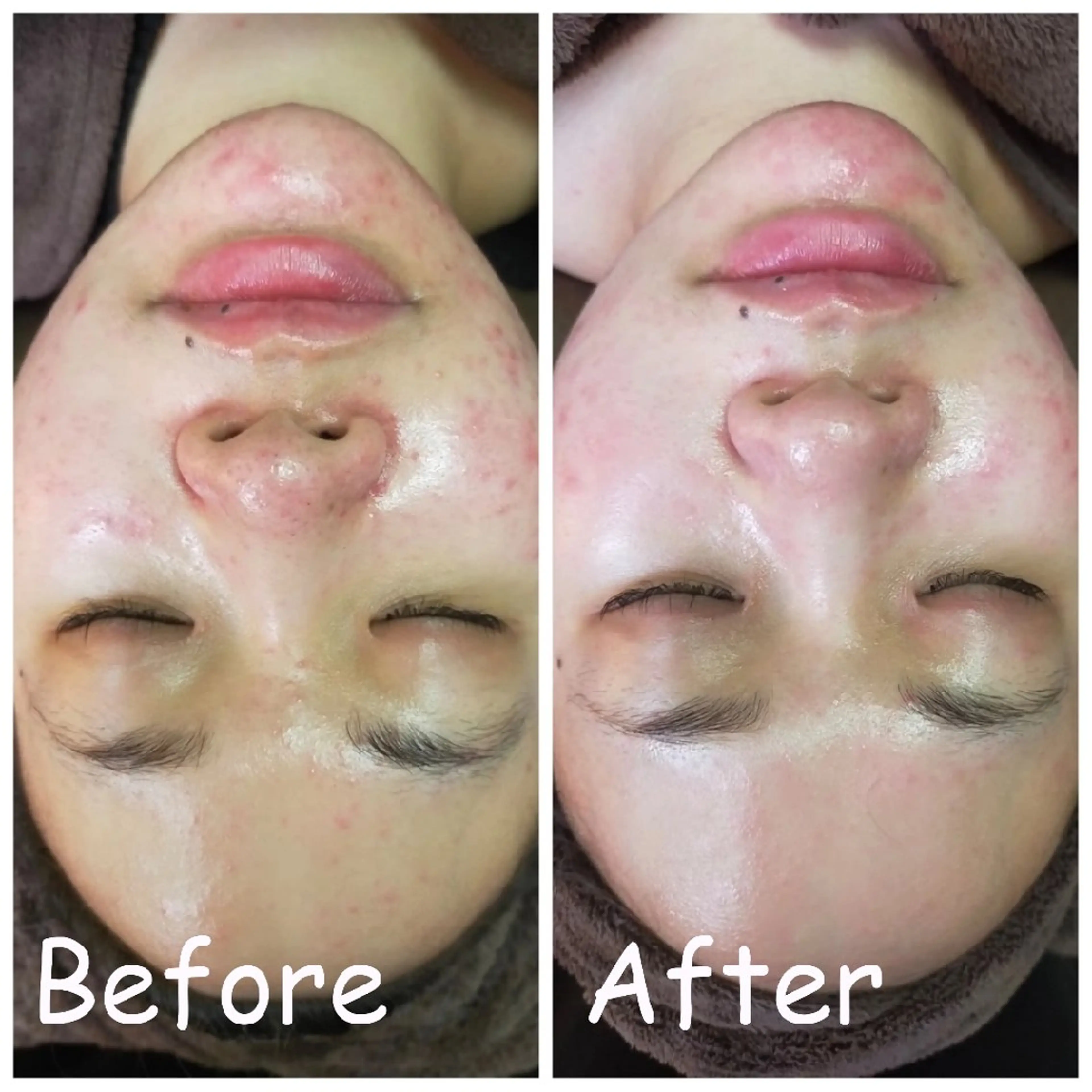 エステ リラク 小顔艶肌＆痩身サロン 🍋 Meguのエステ・リラクイメージ