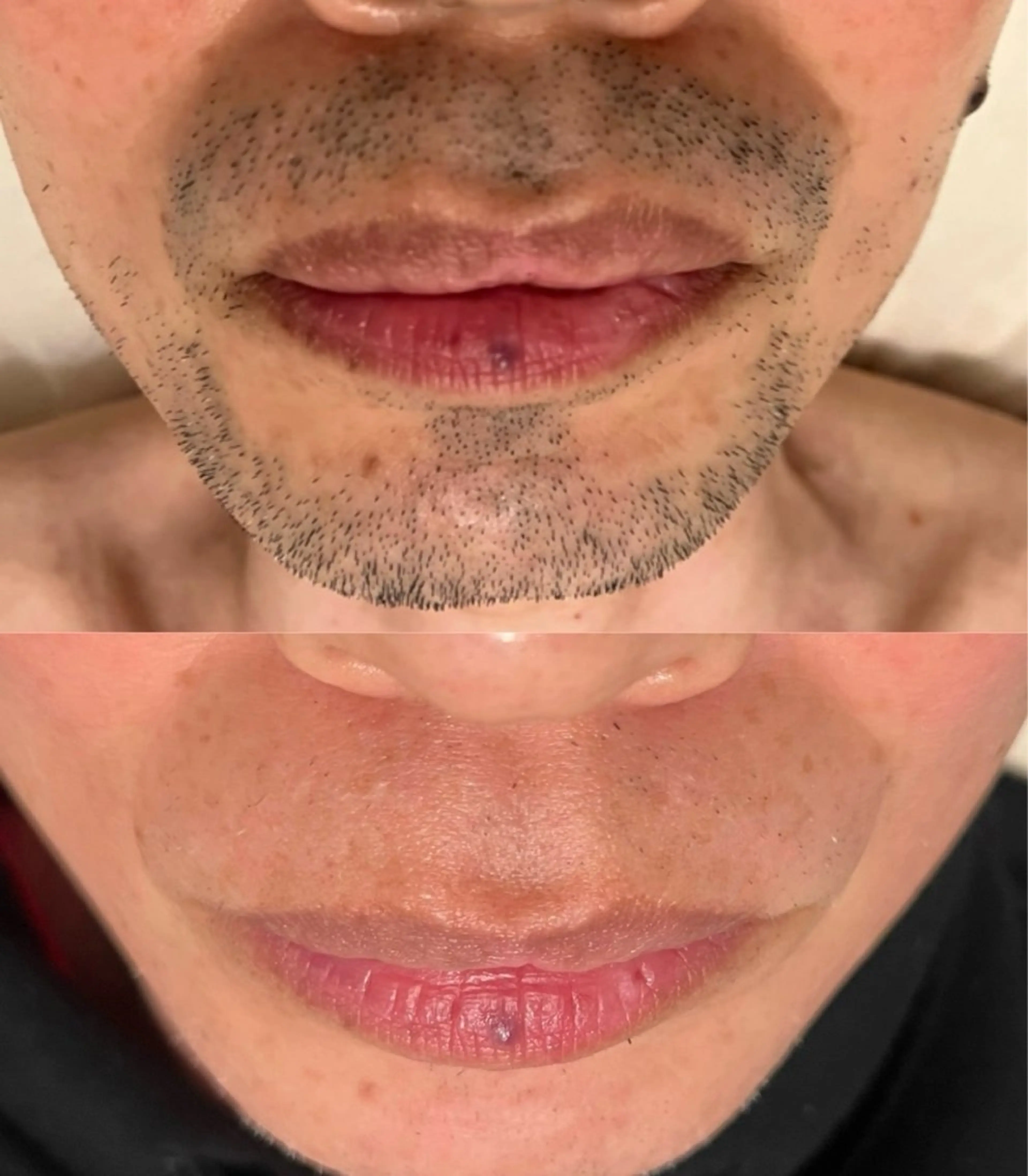 メンズ 脱毛 Butterfly 平塚店　佐藤のエステ・リラクイメージ