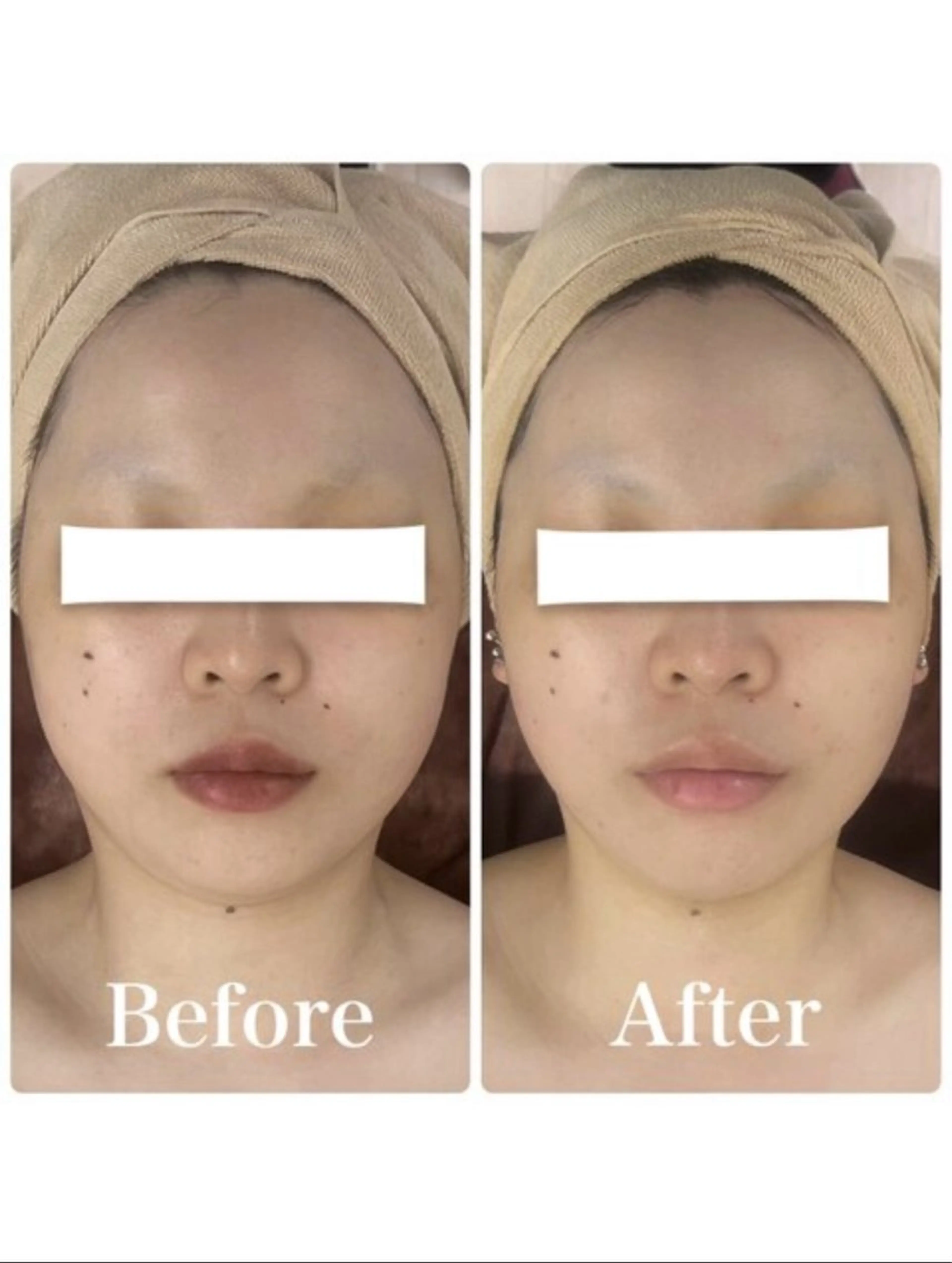 メンズ エステ リラク 小顔フェイシャル 専門店Soarのエステ・リラクイメージ