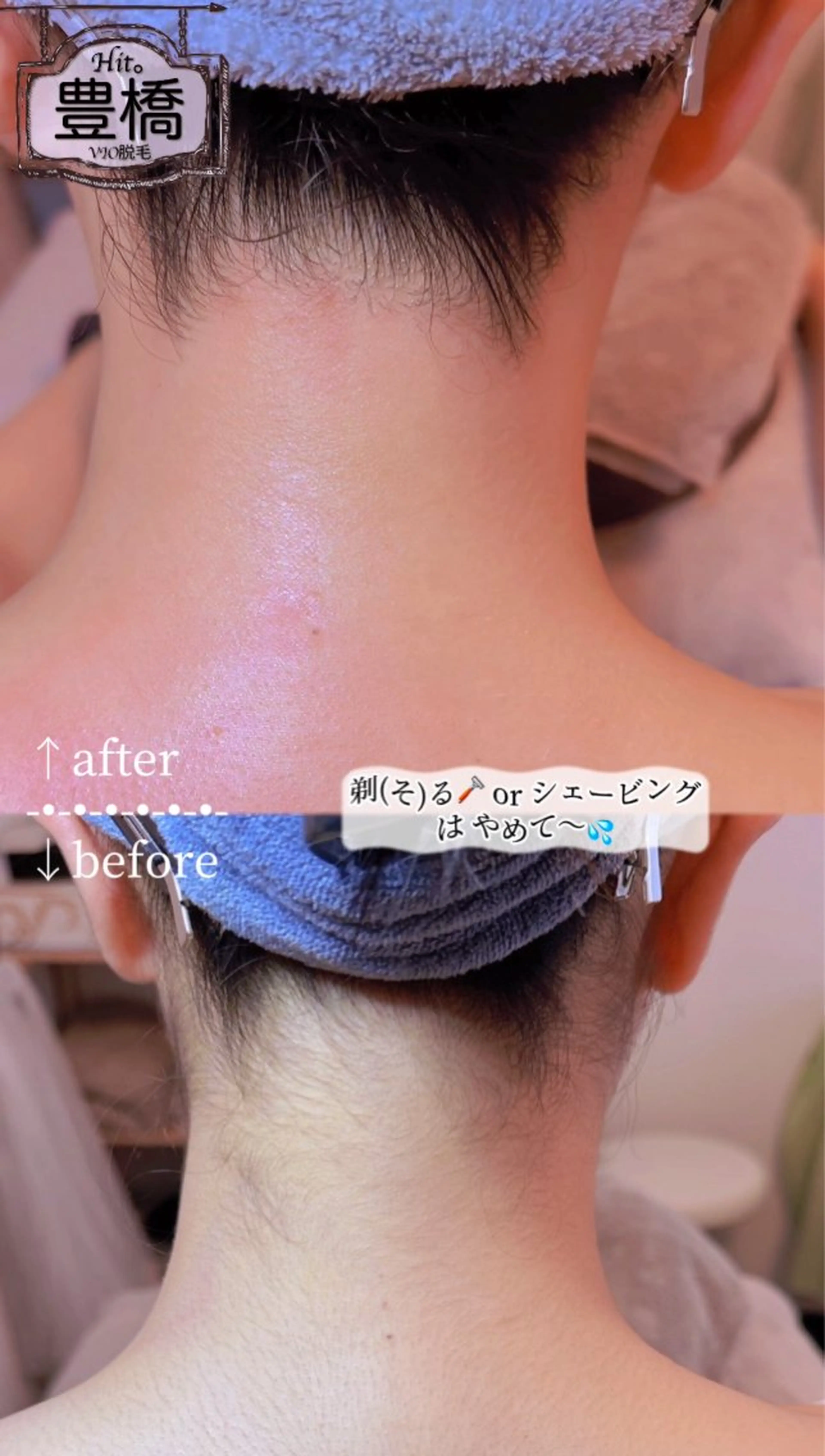 Hit. シュガーリング豊橋のエステ・リラクイメージ