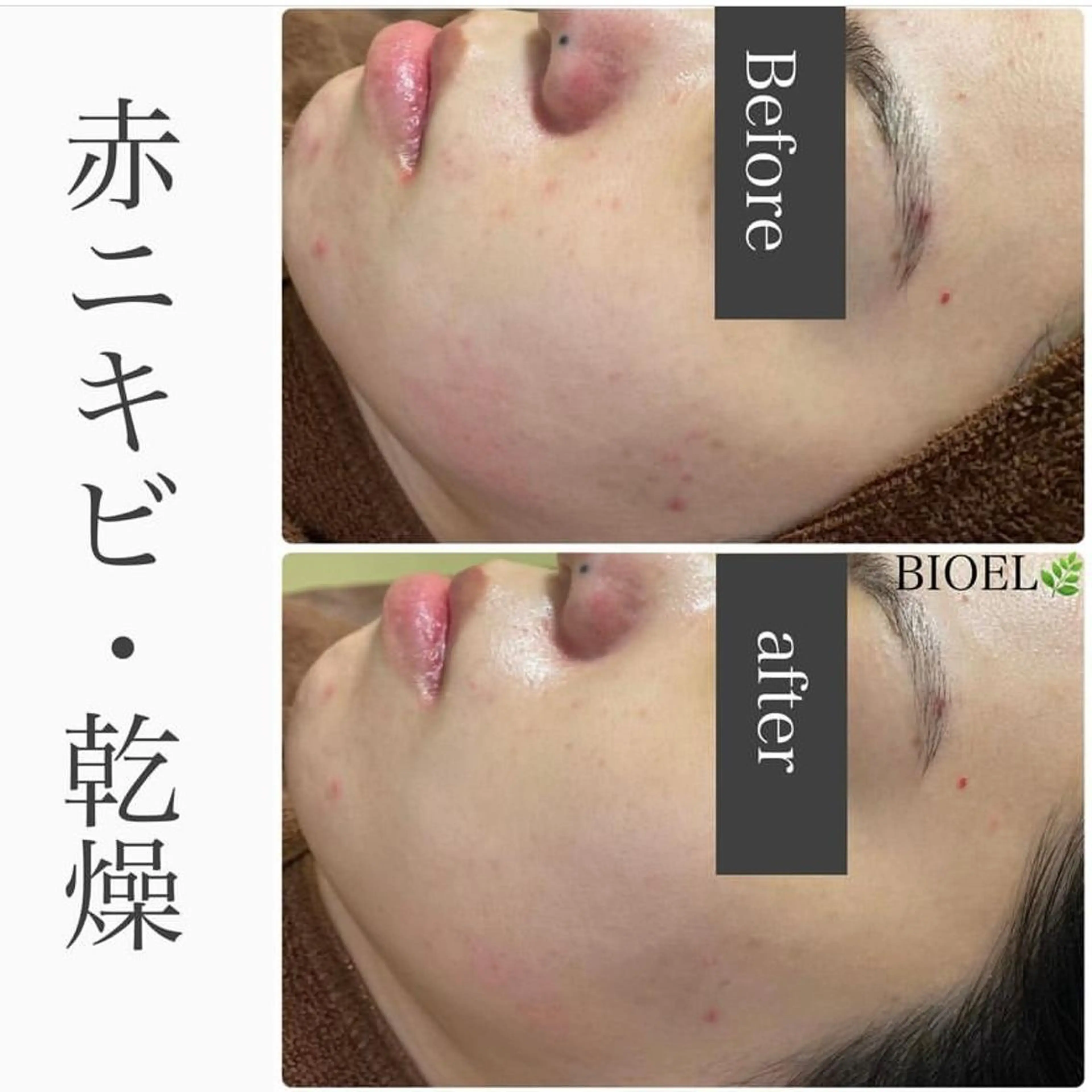 エステ ハーブピーリング専門 BIOPLUS＋川崎のエステ・リラクイメージ