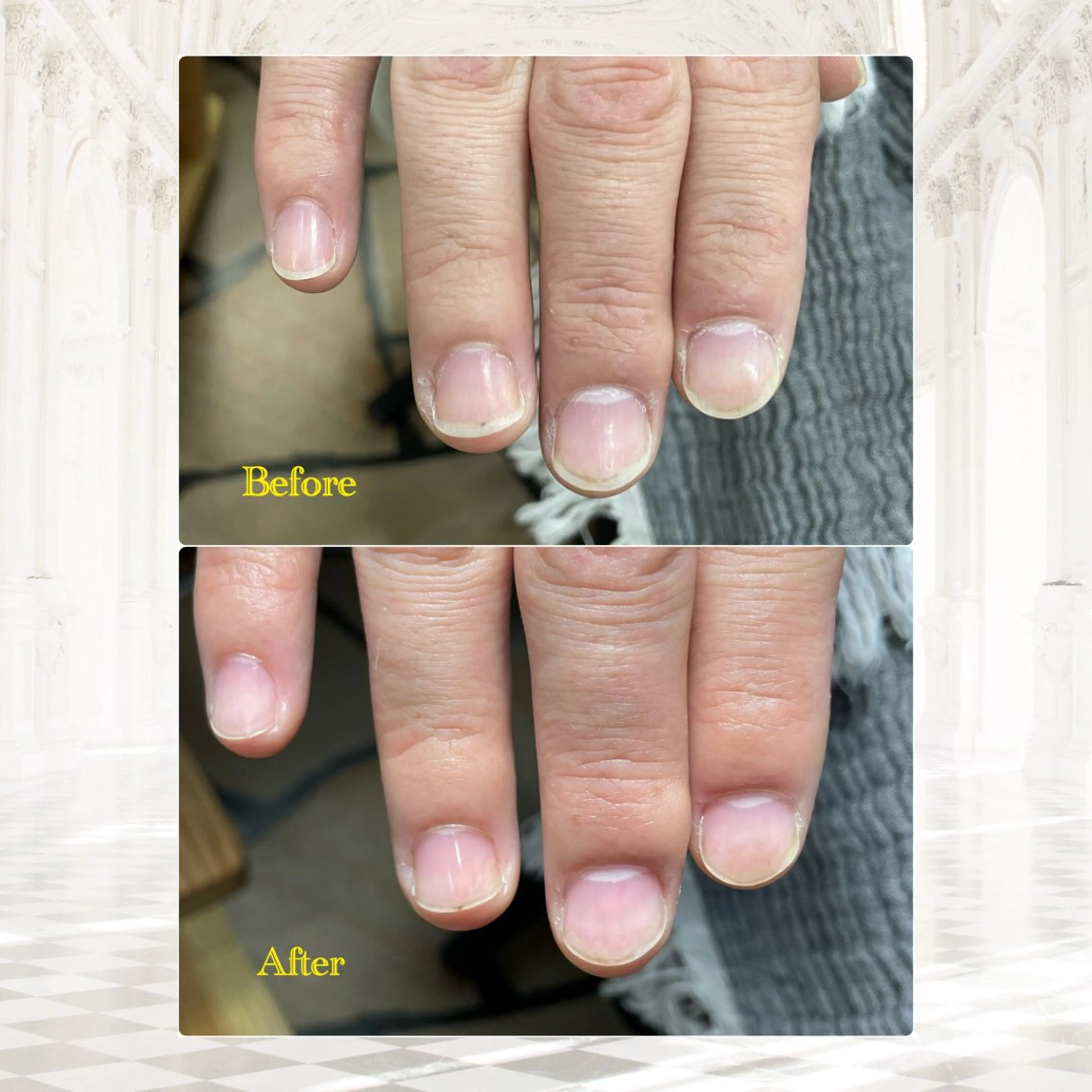 メンズ自爪お手入れコースの写真