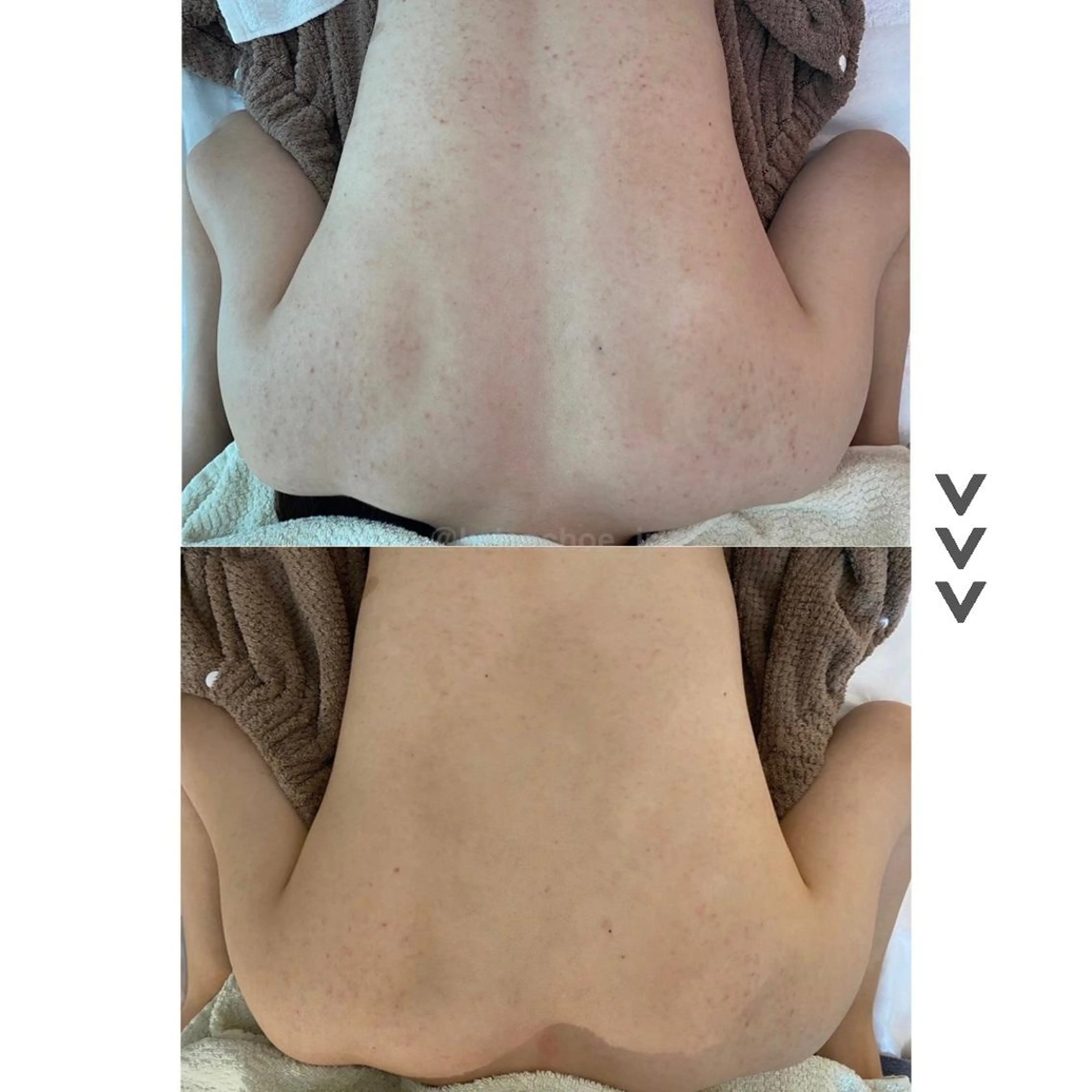 エステ 肌質改善 KALANCHOEのエステ・リラクイメージ