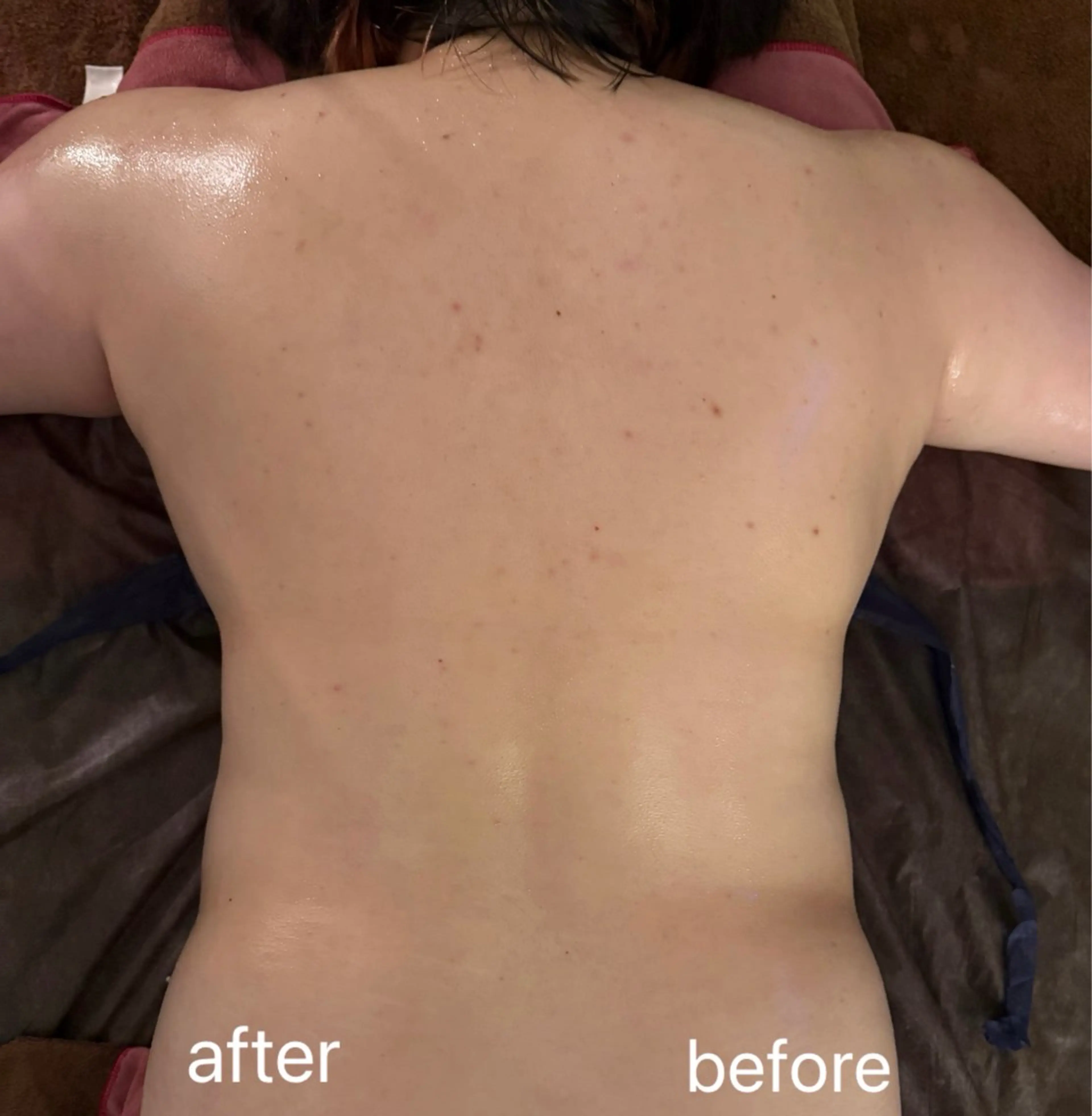 ミニモ期間限定⭐︎【ボディトータルケア｜120分】痩身機器『セルライトゼロ2』×バザルトストーンの写真