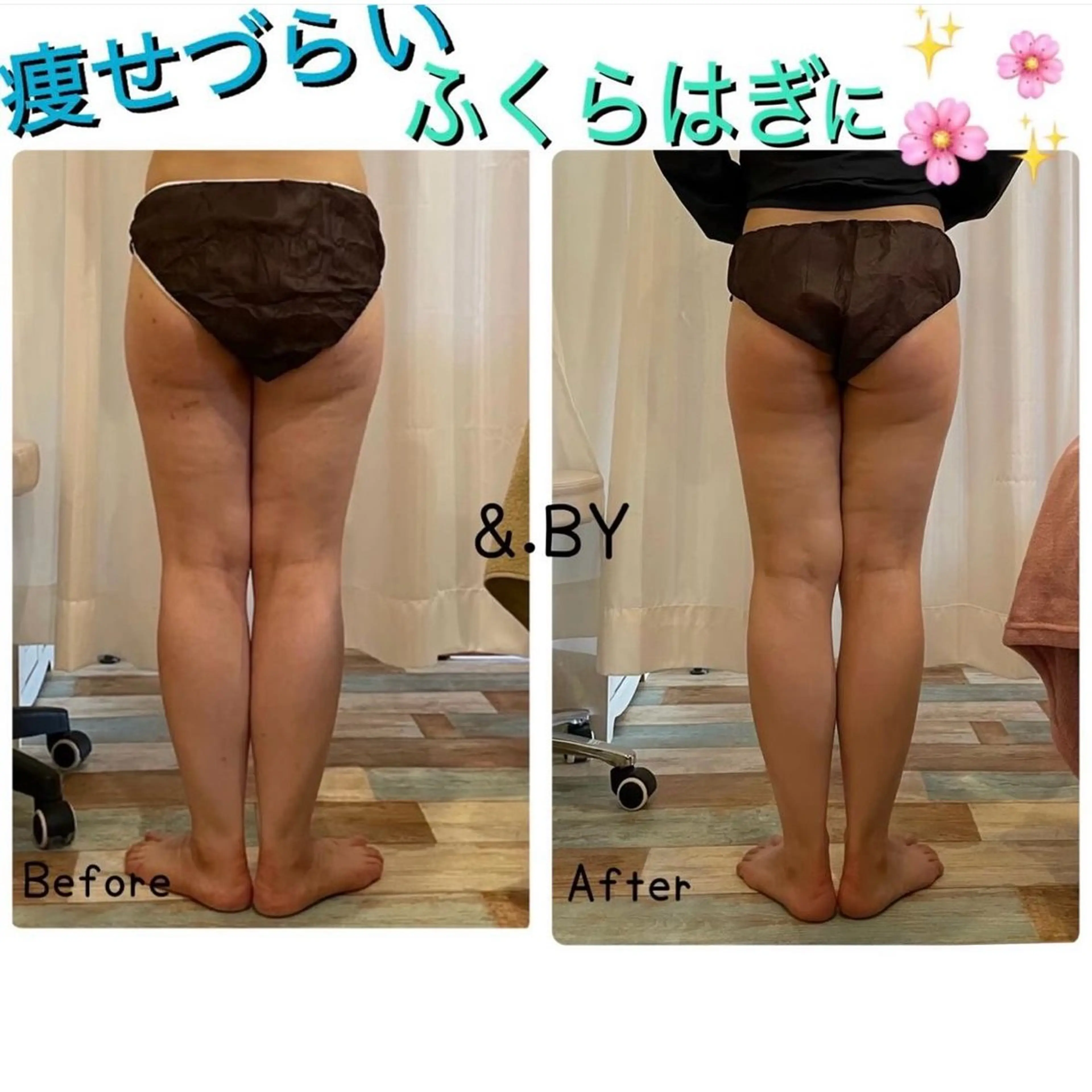 【セルライト/むくみ/冷え解消♪】とにかく痩せたい方‼️下半身集中 60min¥4,400の写真