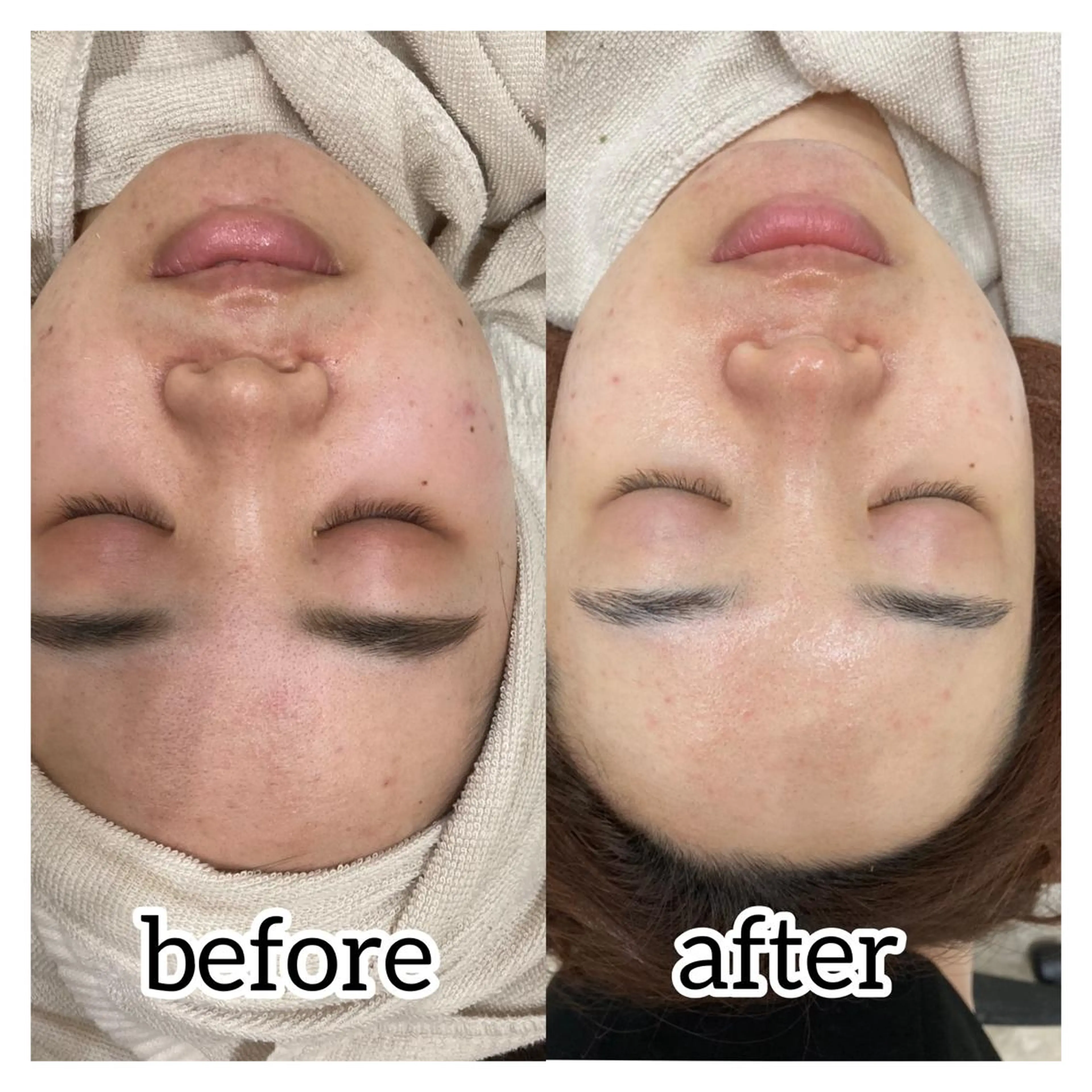 laluna saki...のその他イメージ