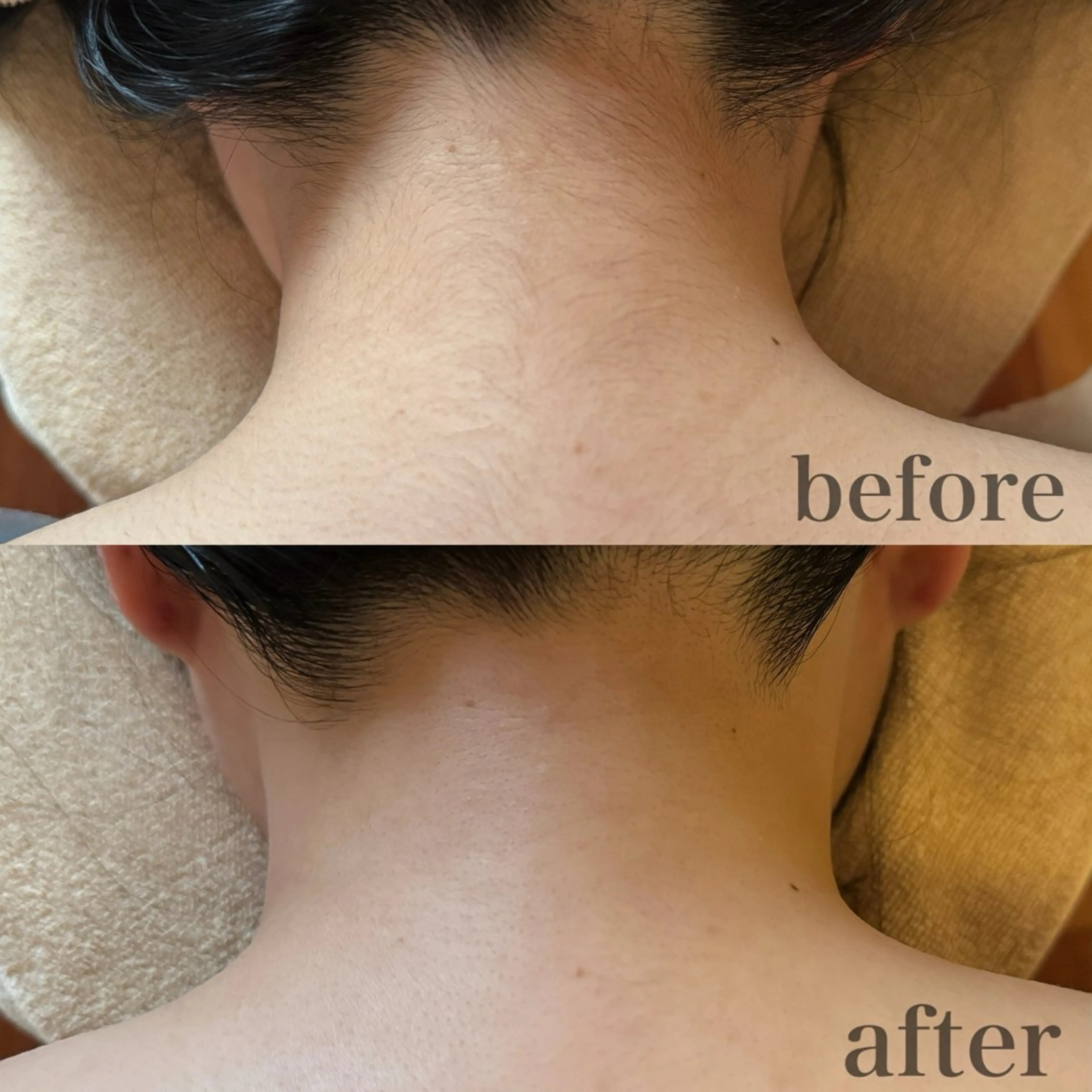 脱毛 merci salon所属・mercisalon 豊橋店mikuのエステ・リラクイメージ