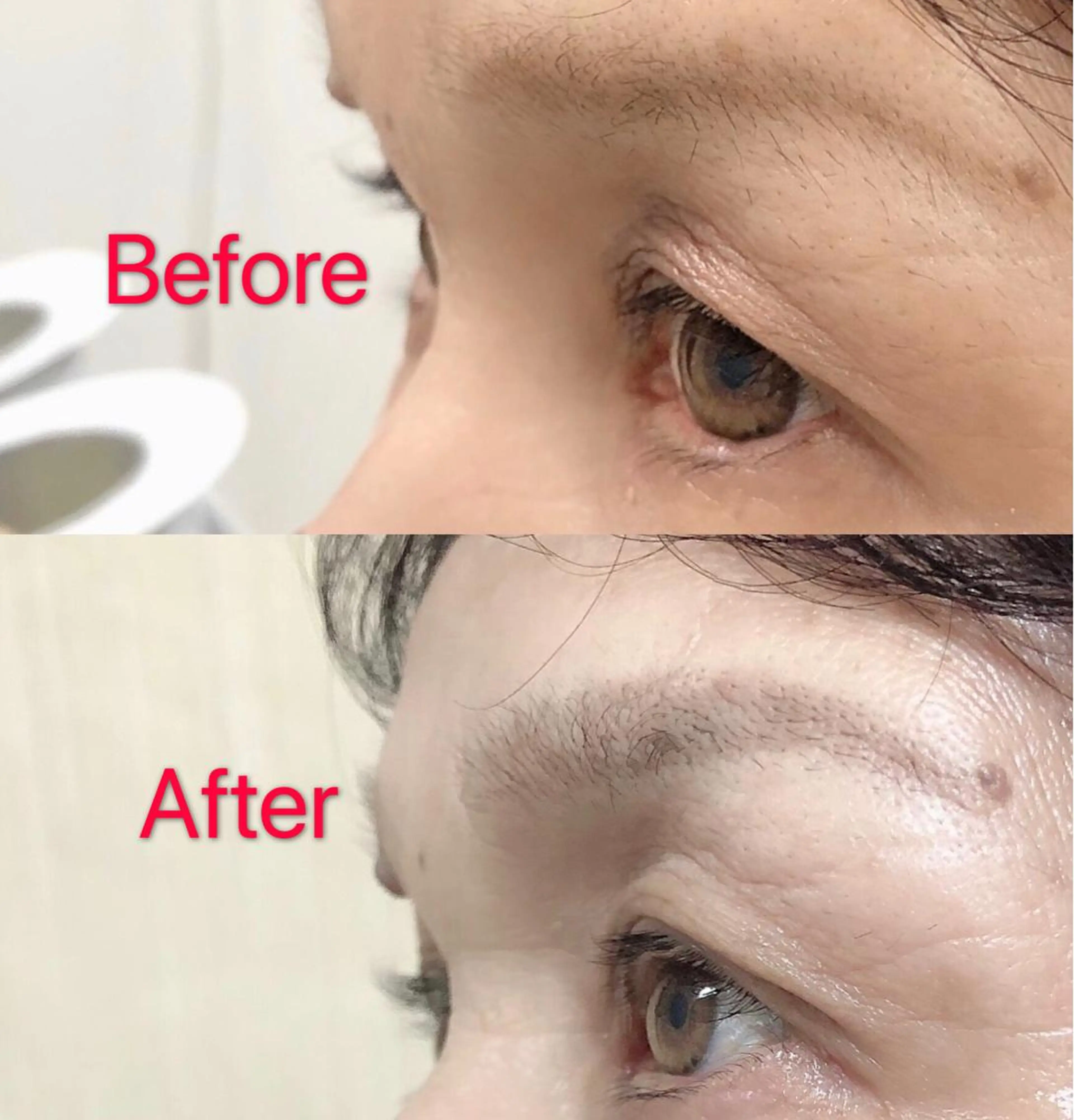 ワックス脱毛 East AkkA eyelash所属・オザキ -のマツエク・マツパデザイン