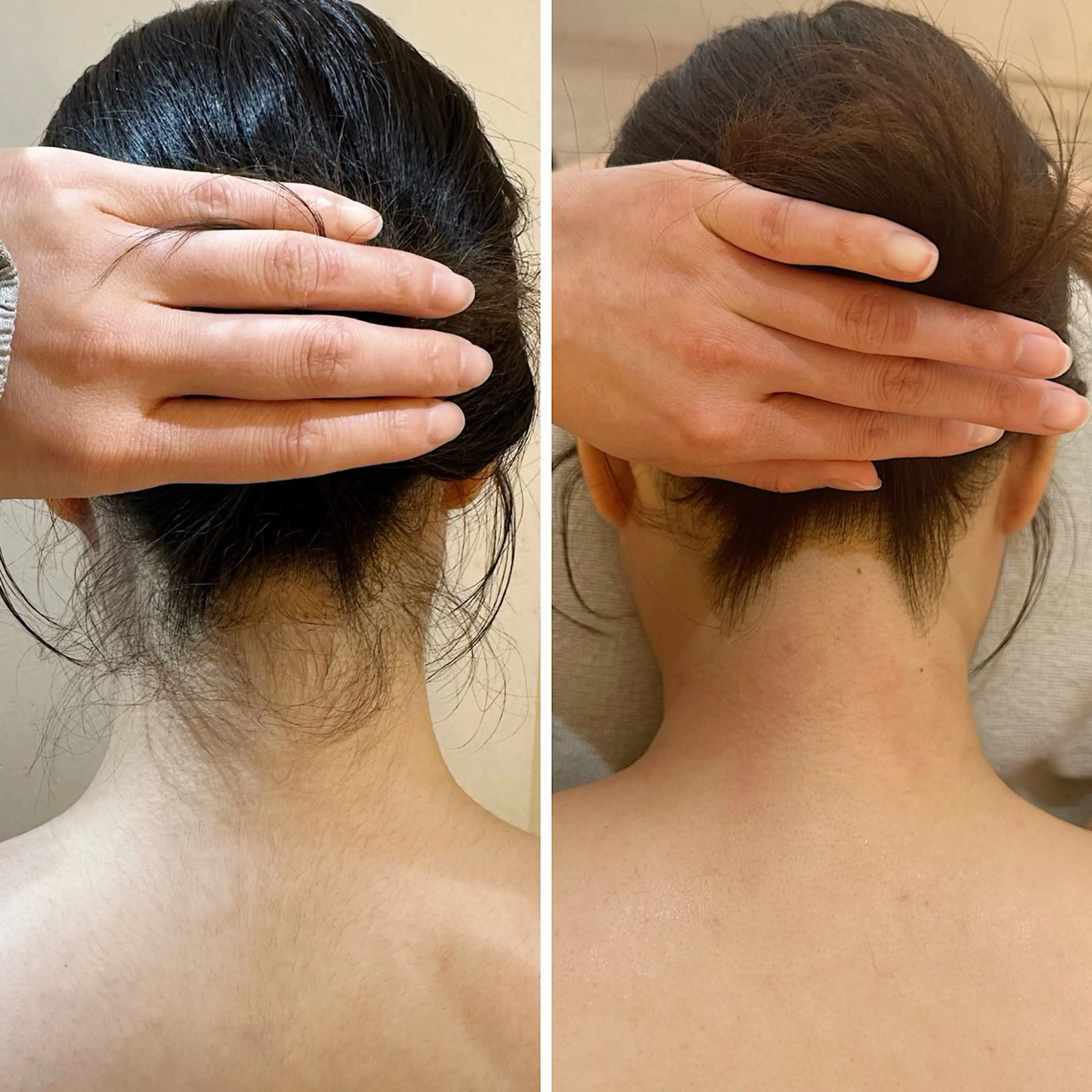 脱毛 うなじ脱毛/美肌脱毛 LABELのエステ・リラクイメージ