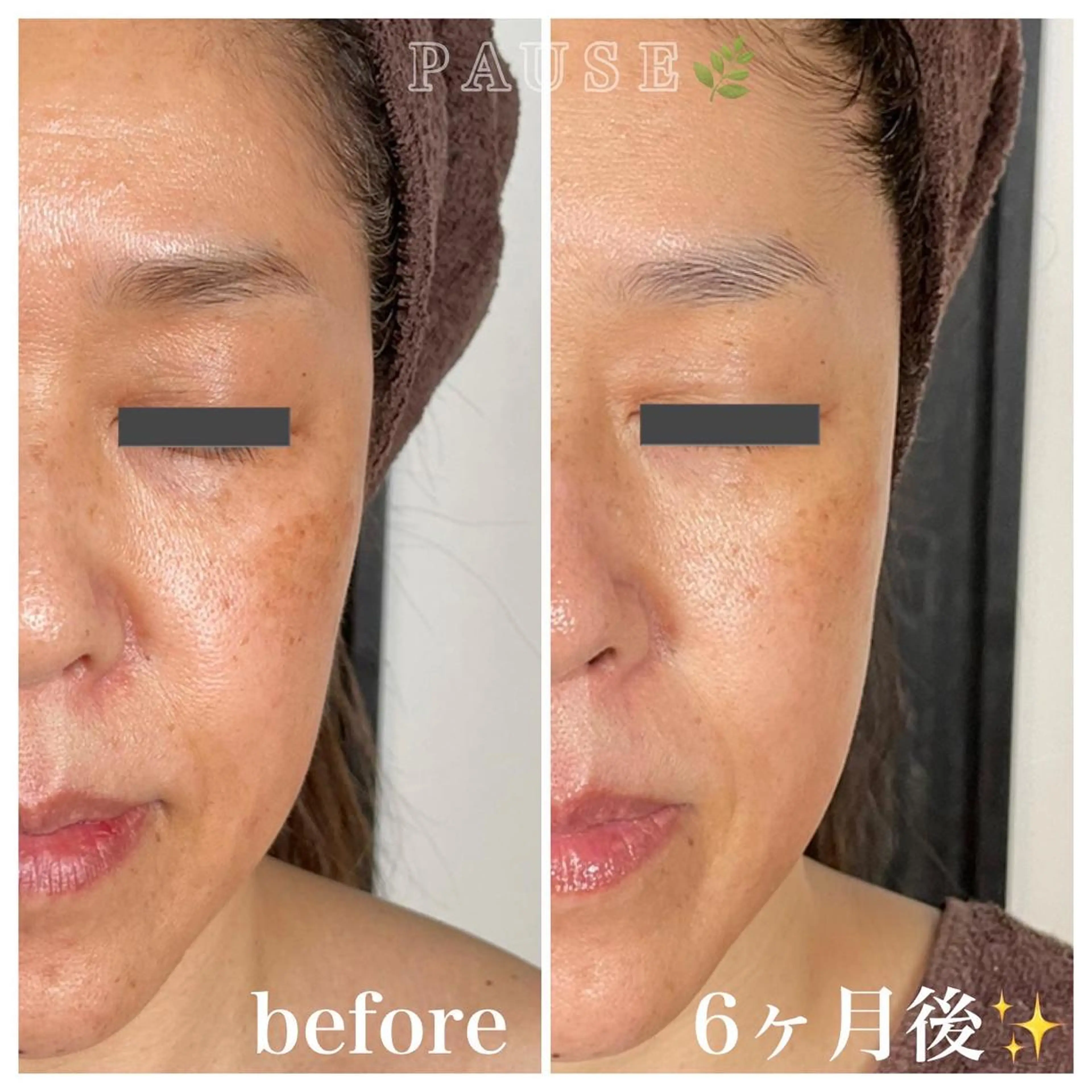 エステ 浜野 恵美のエステ・リラクイメージ