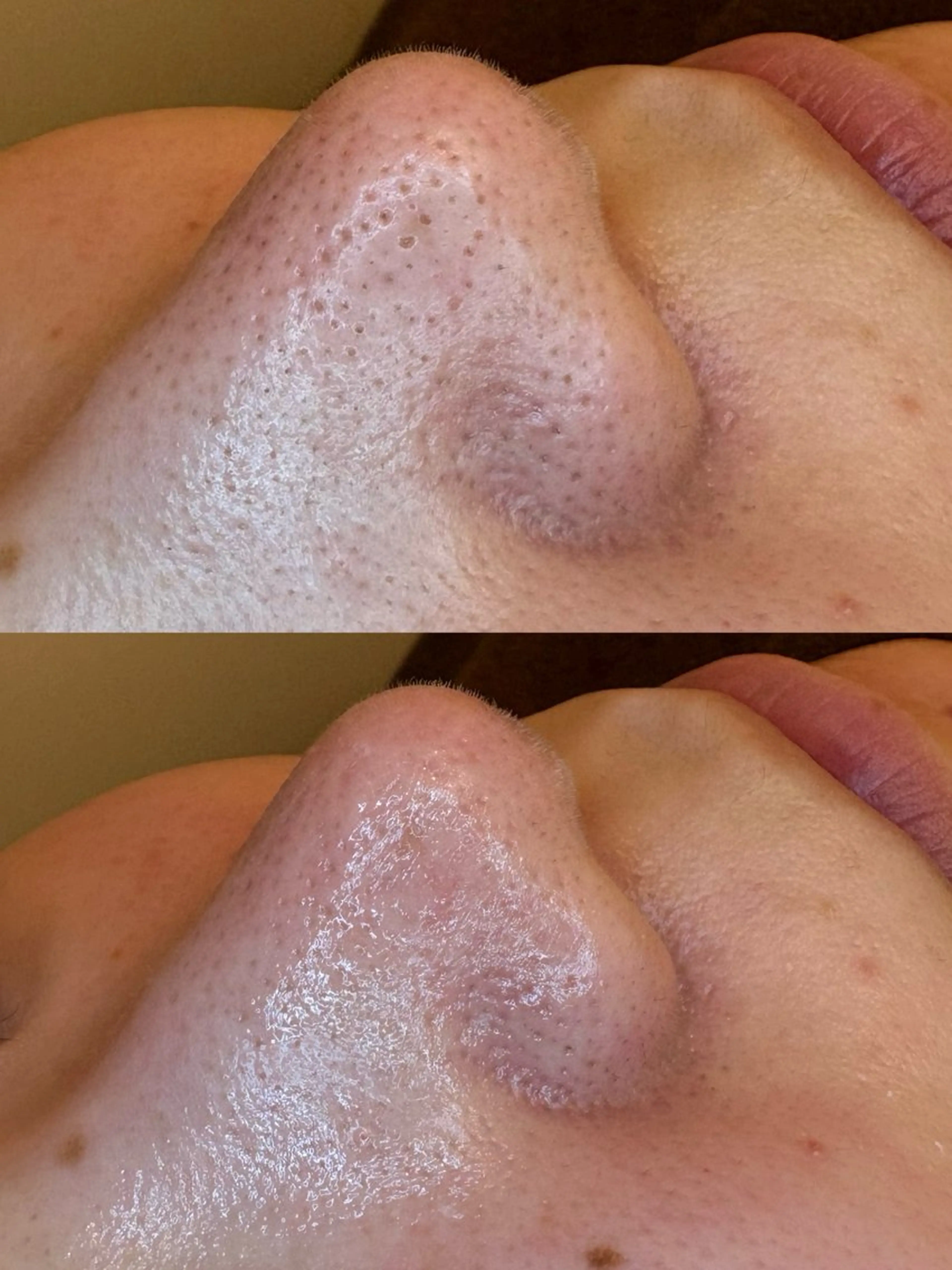 エステ EARTH coiffure beaute 新潟紫竹山店所属・🤍アベシュリ /フェイシャル🤍のエステ・リラクイメージ