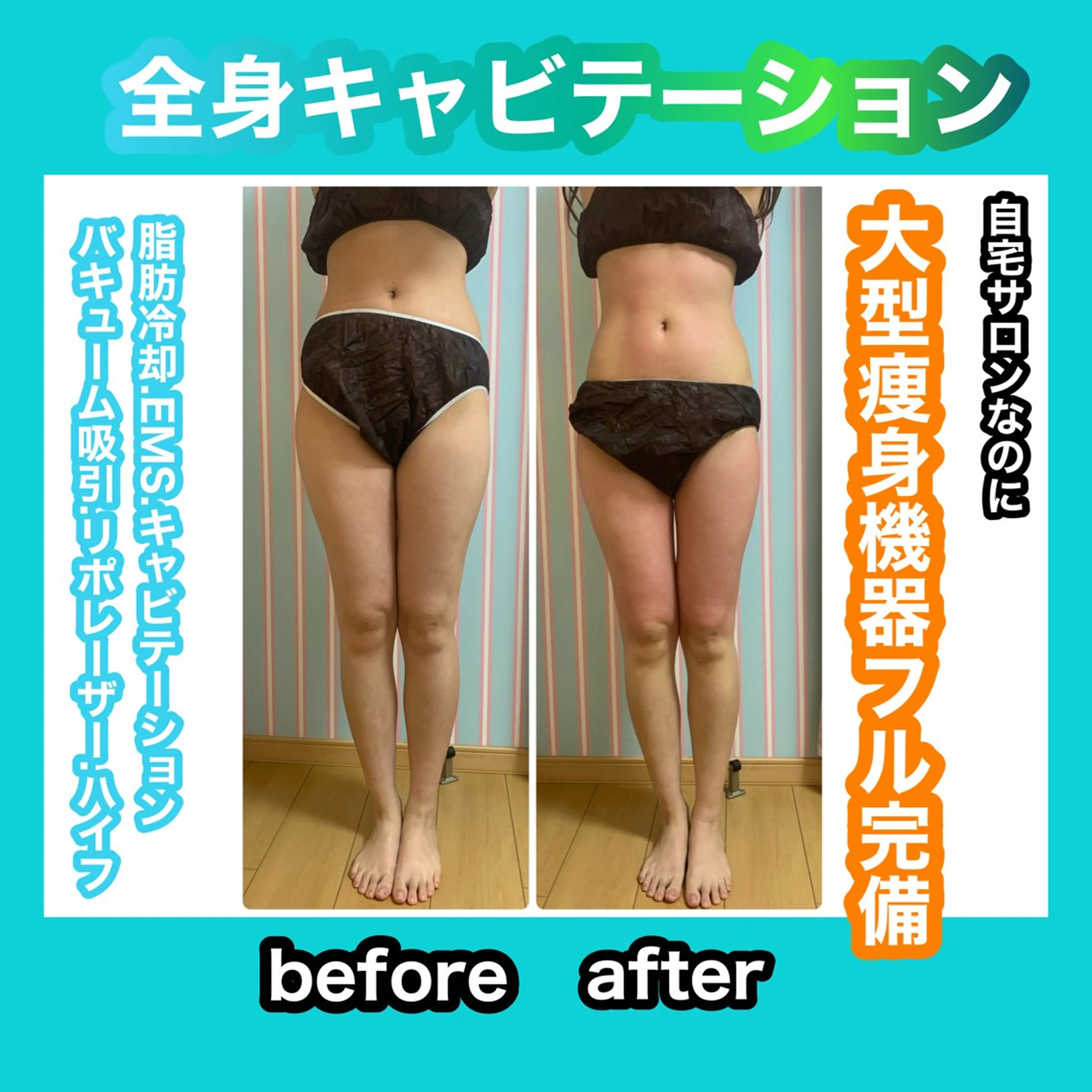 エステ リラク 痩身/脱毛/ネイル HARUKAのエステ・リラクイメージ