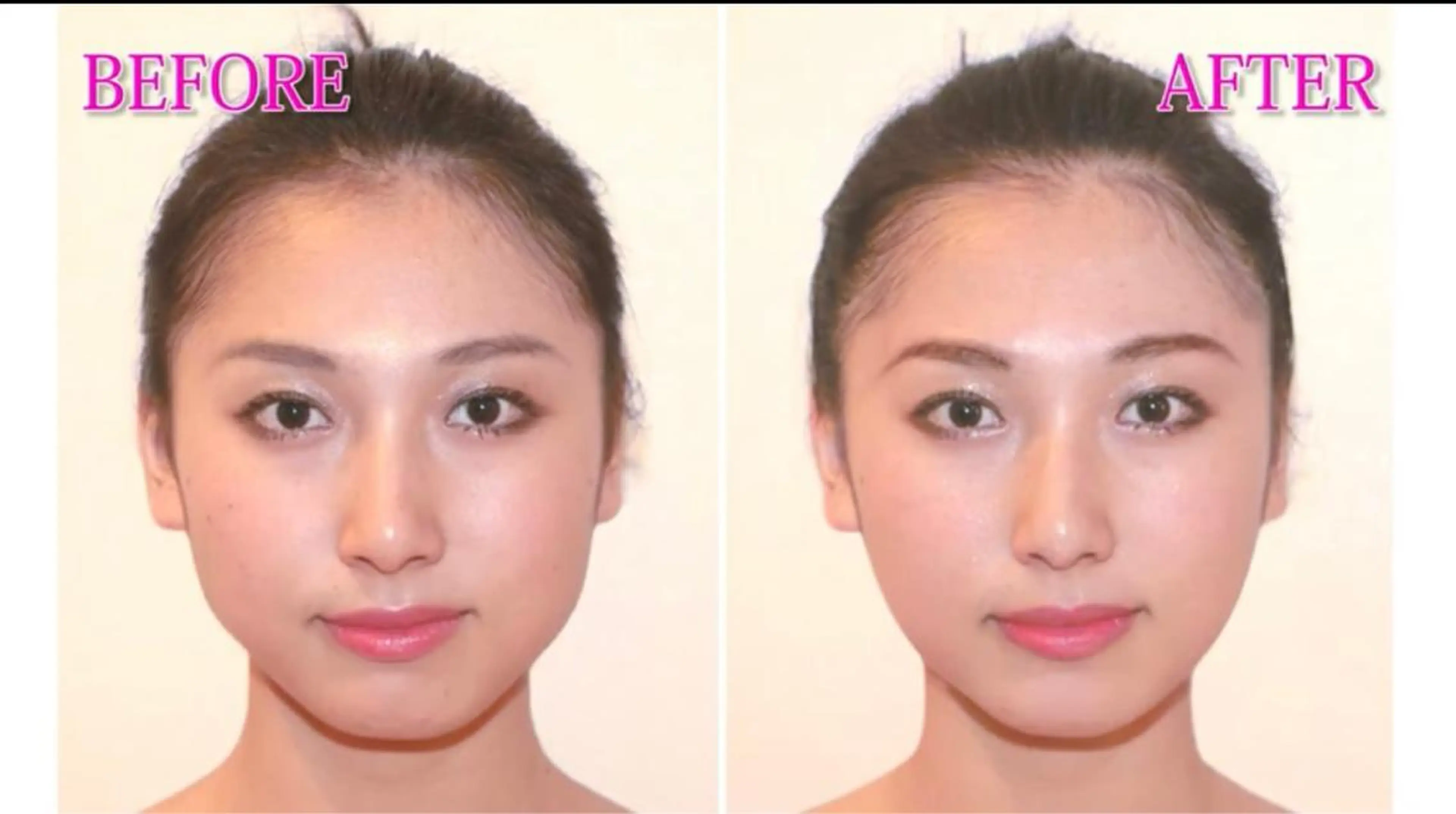 【ハイパーナイフ痩身&小顔コルギ&ハーブピーリング】K-Beauty　東新宿所属・kーbeauty小顔 コルギ&インディバのエステ・リラクイメージ