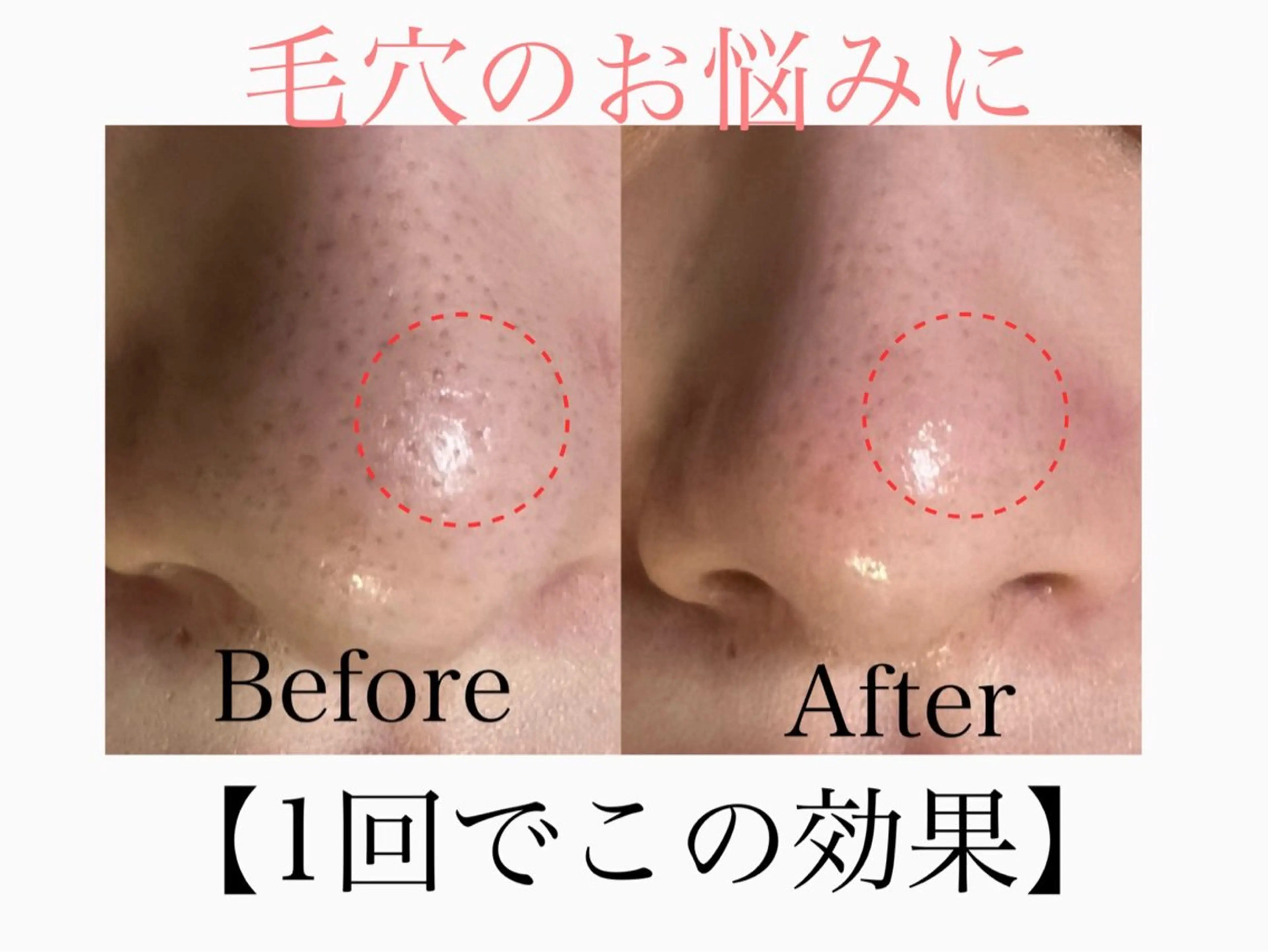 エステ 六本木脱毛andS 店長Sachiのエステ・リラクイメージ