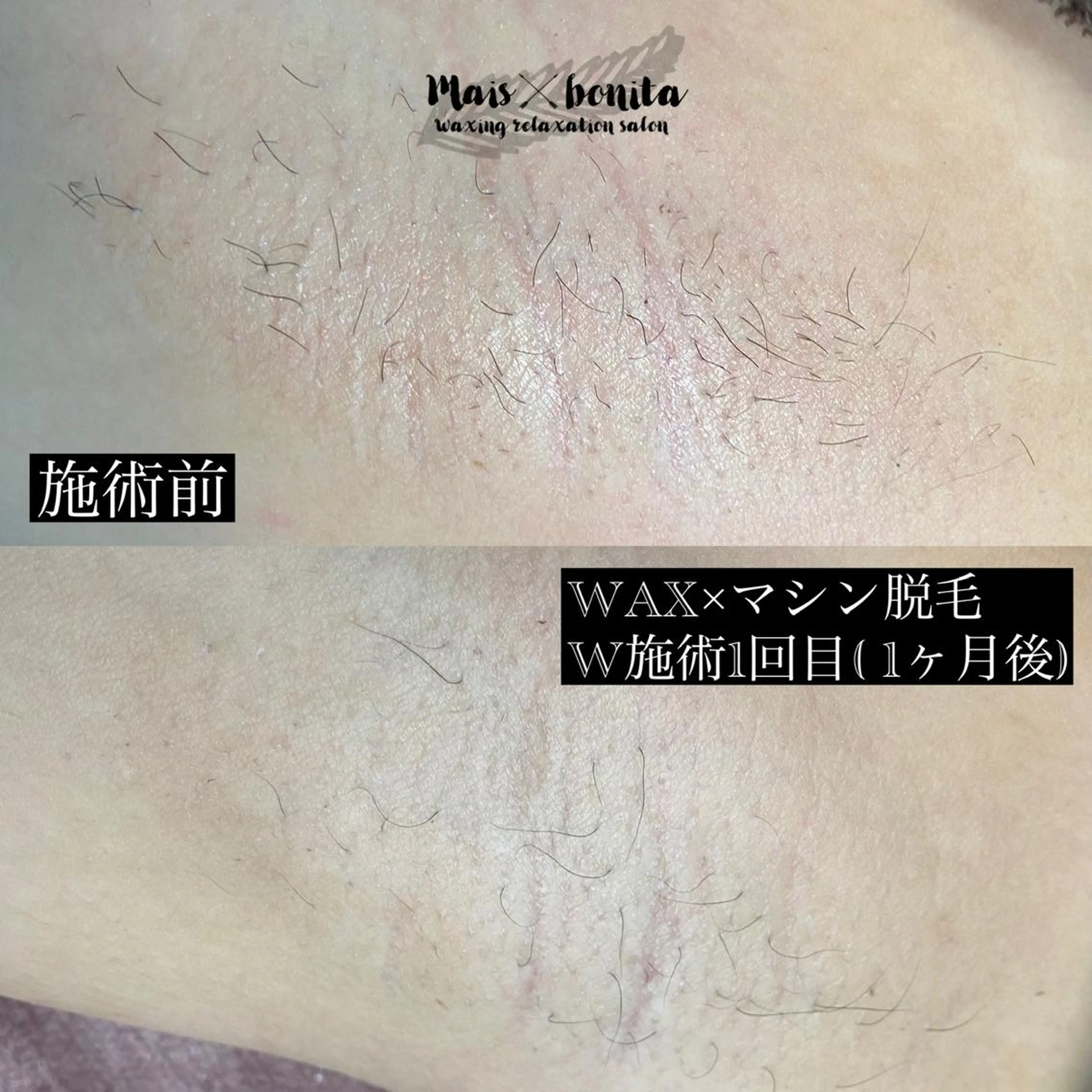 脱毛 【mais bonita】メイスボニータ所属・maisbonita waxingのエステ・リラクイメージ