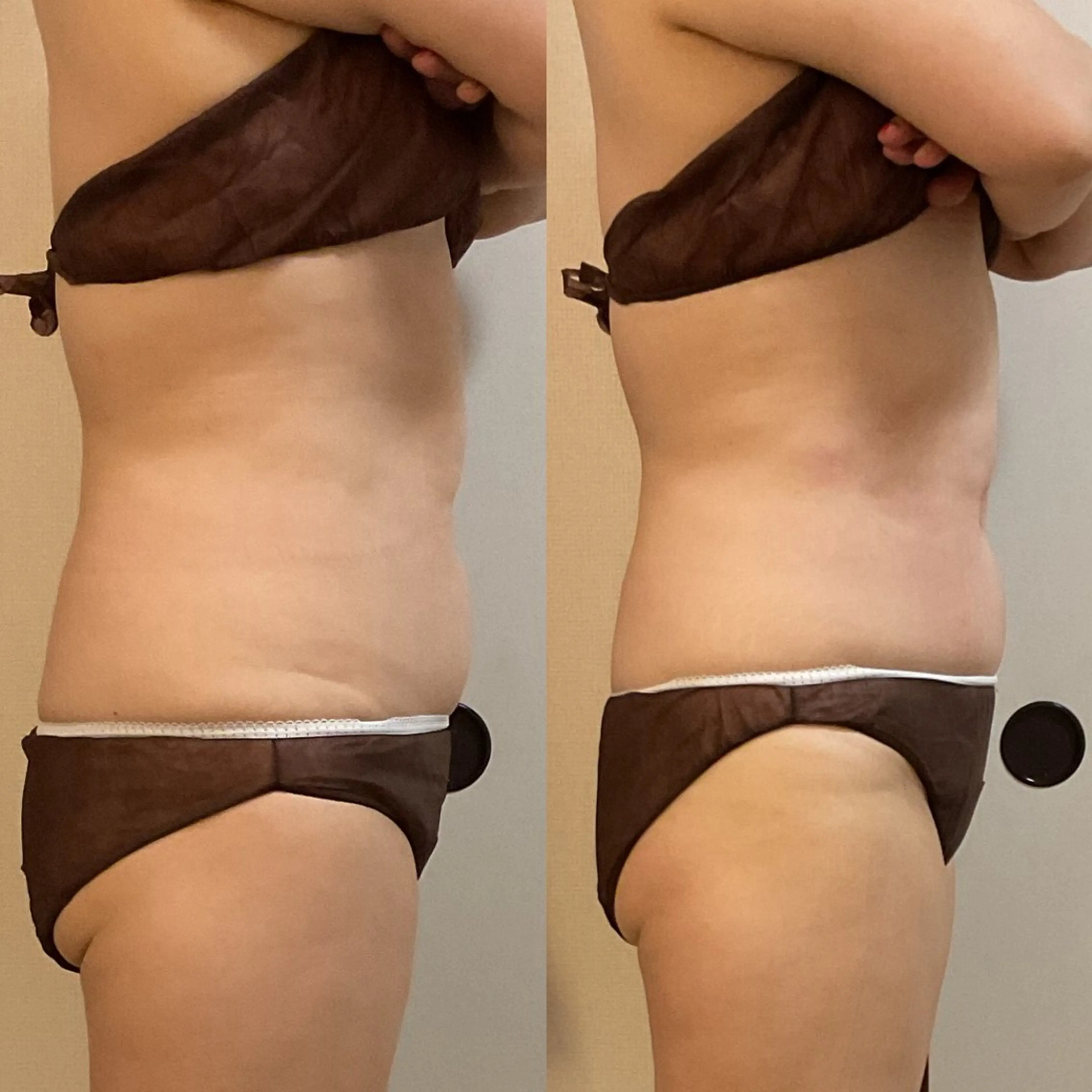 その他 宮崎 美桜のエステ・リラクイメージ