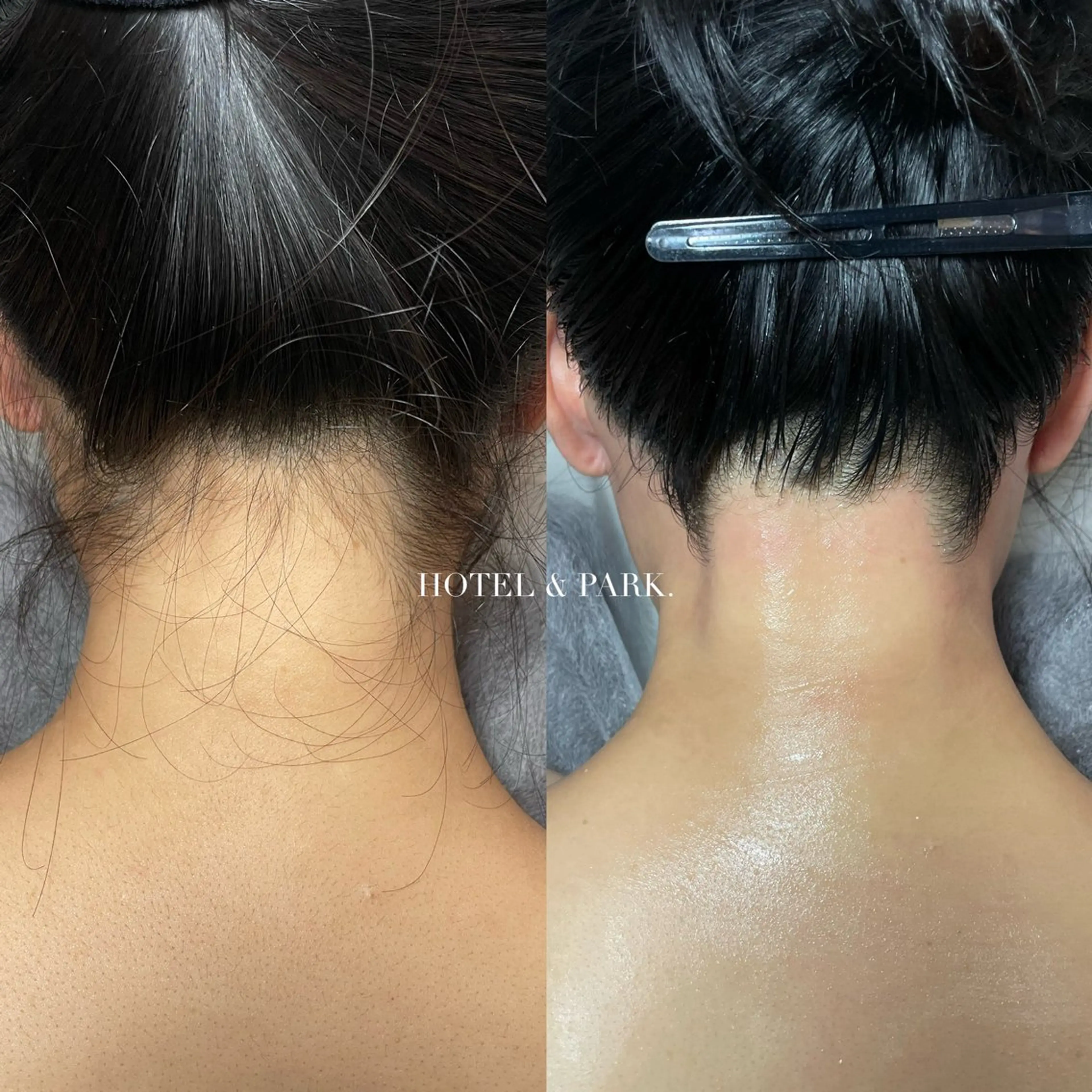 脱毛 HOTEL&PARK . ワックス脱毛のエステ・リラクイメージ