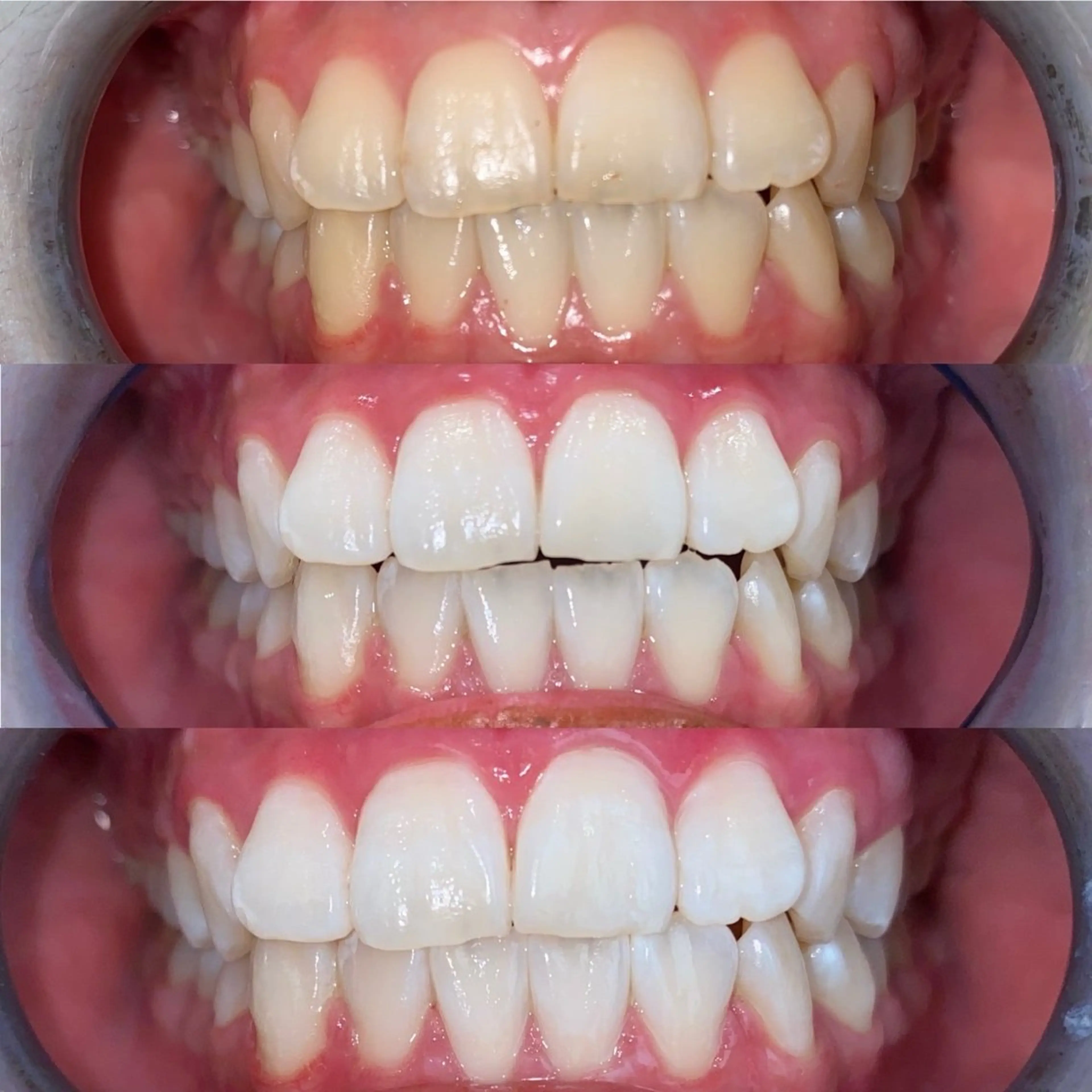 ホワイトニングサロンaile所属・セルフホワイトニング 金城しおりのその他イメージ