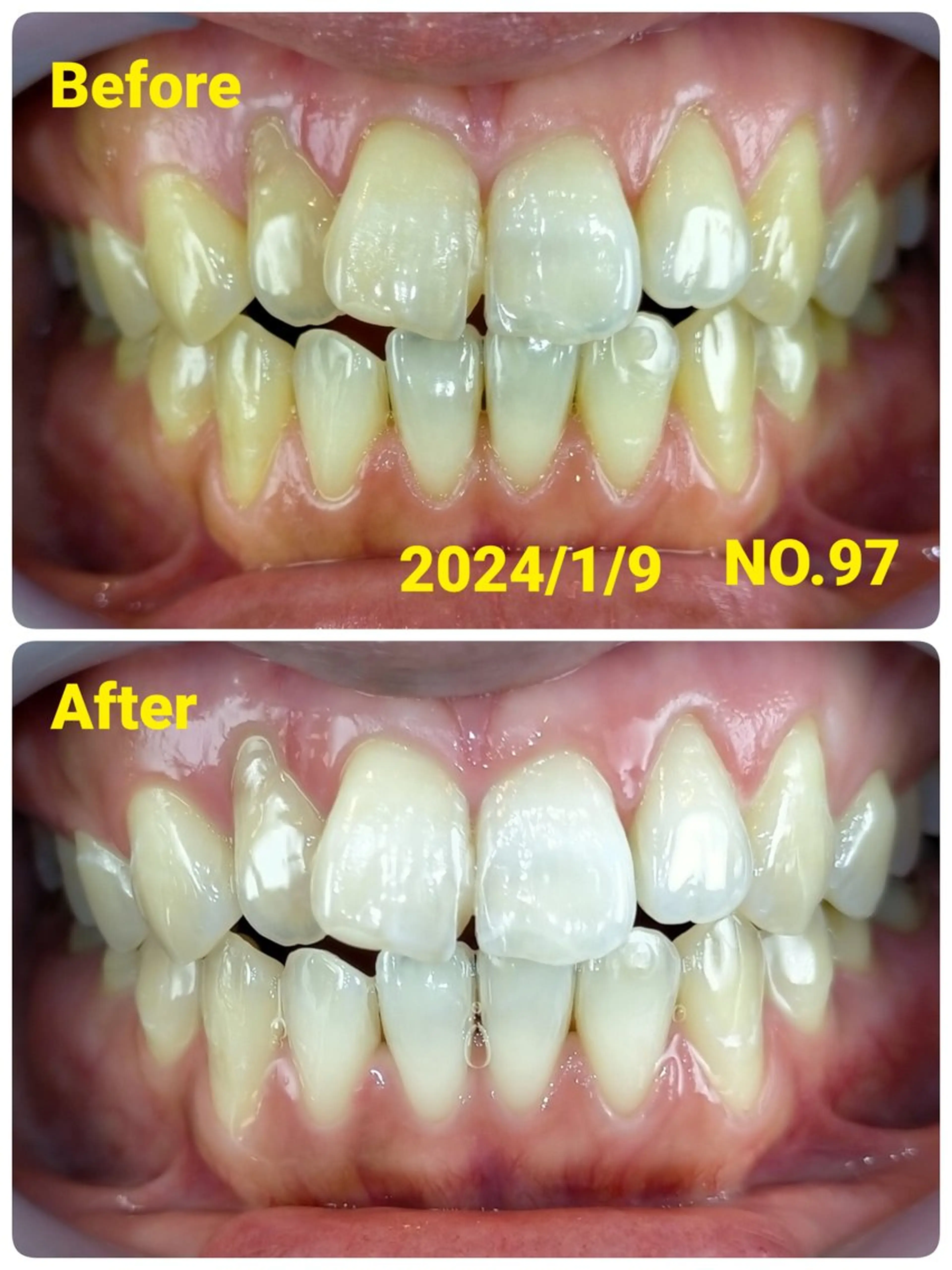 小松 樹以(歯のセルフホワイトニング専門店ORAL30 by MANUELA所属)の