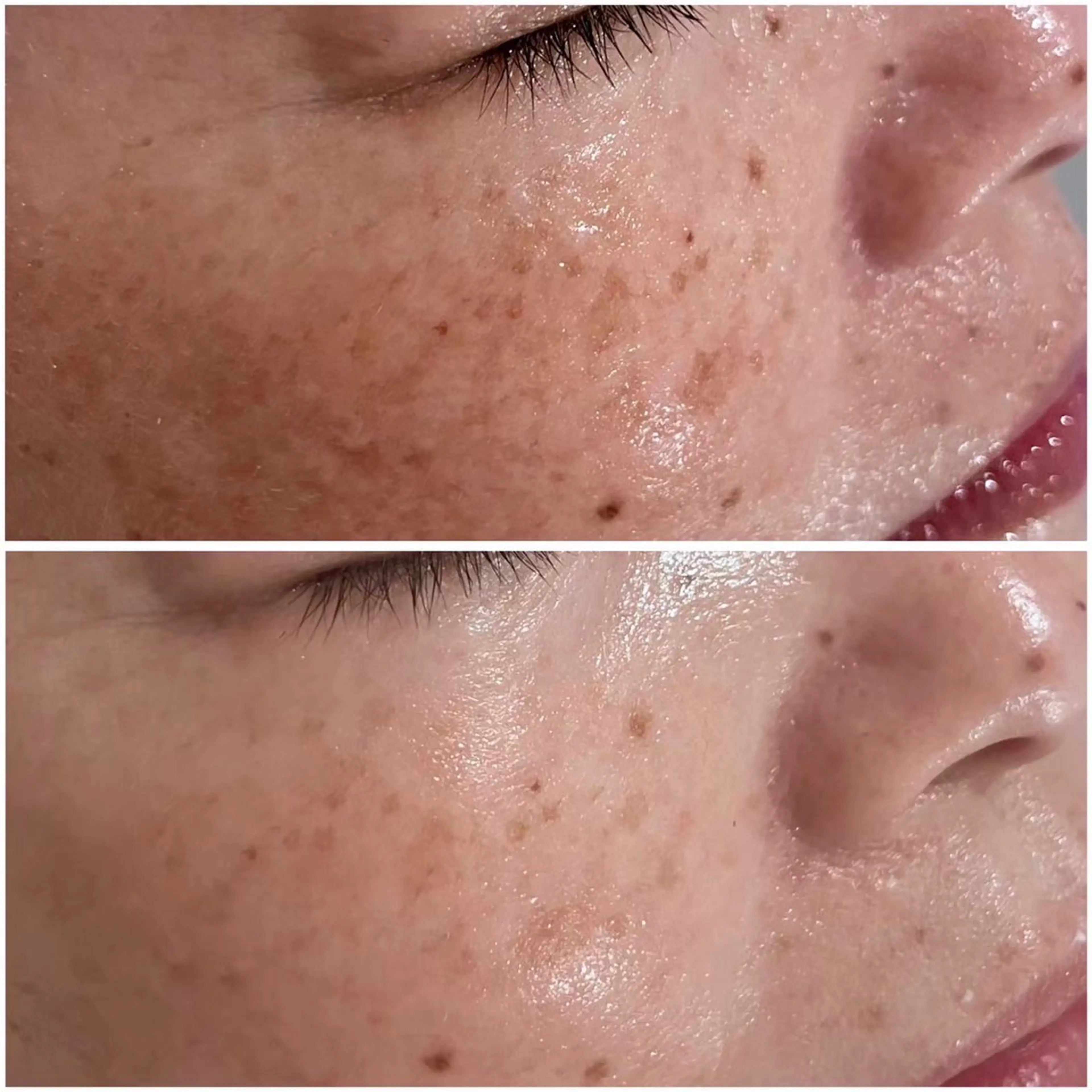🈹60%off✨水光肌✨モデリングパック付き💆‍♀️最強肌質改善フェイシャル80分の写真