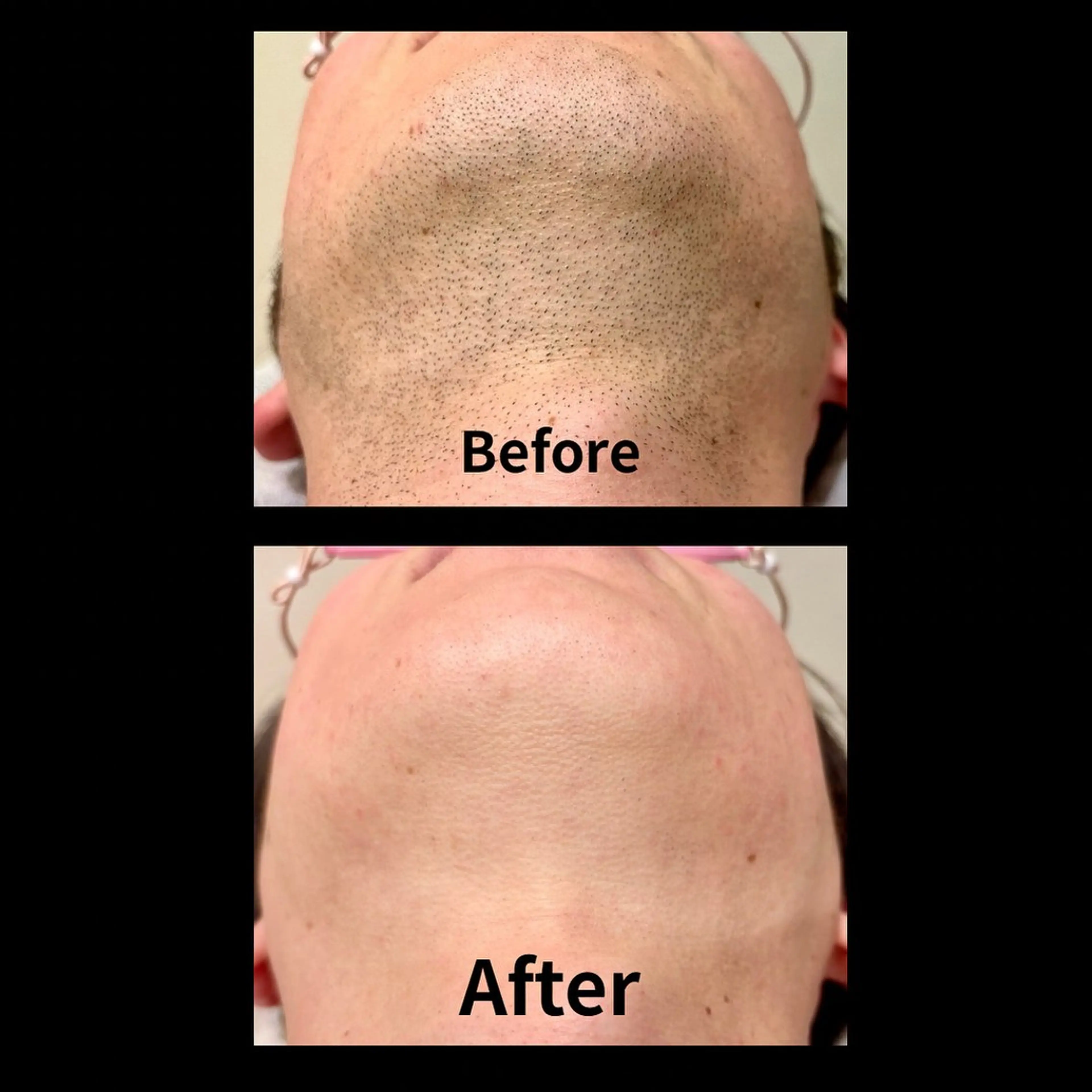 メンズ 脱毛サロン&ドライヘッドスパFIS 溝の口店所属・脱毛サロン FIS 溝の口店のエステ・リラクイメージ