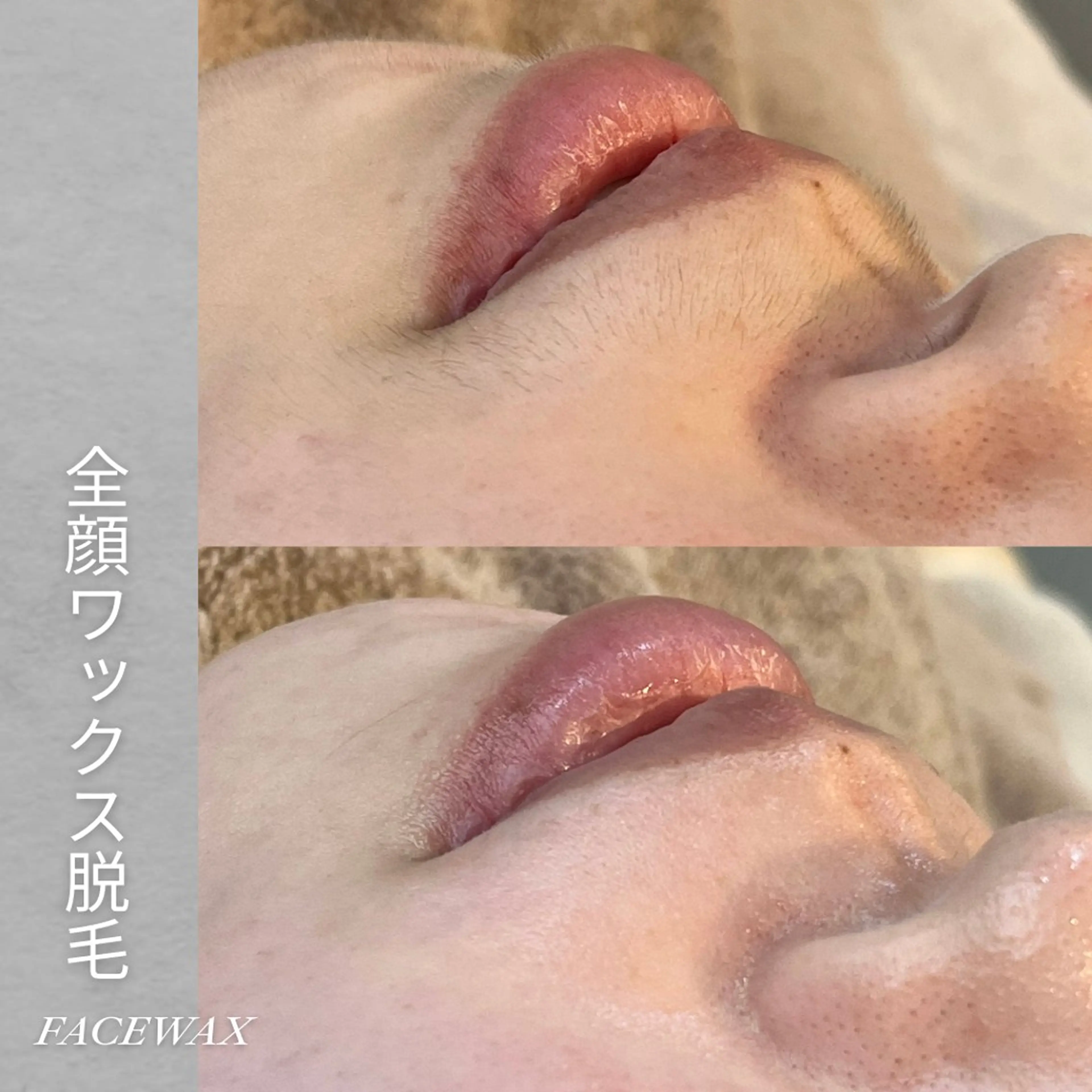 EST BEAUTY所属・顔ワックス脱毛/ ハーブピーリングのエステ・リラクイメージ