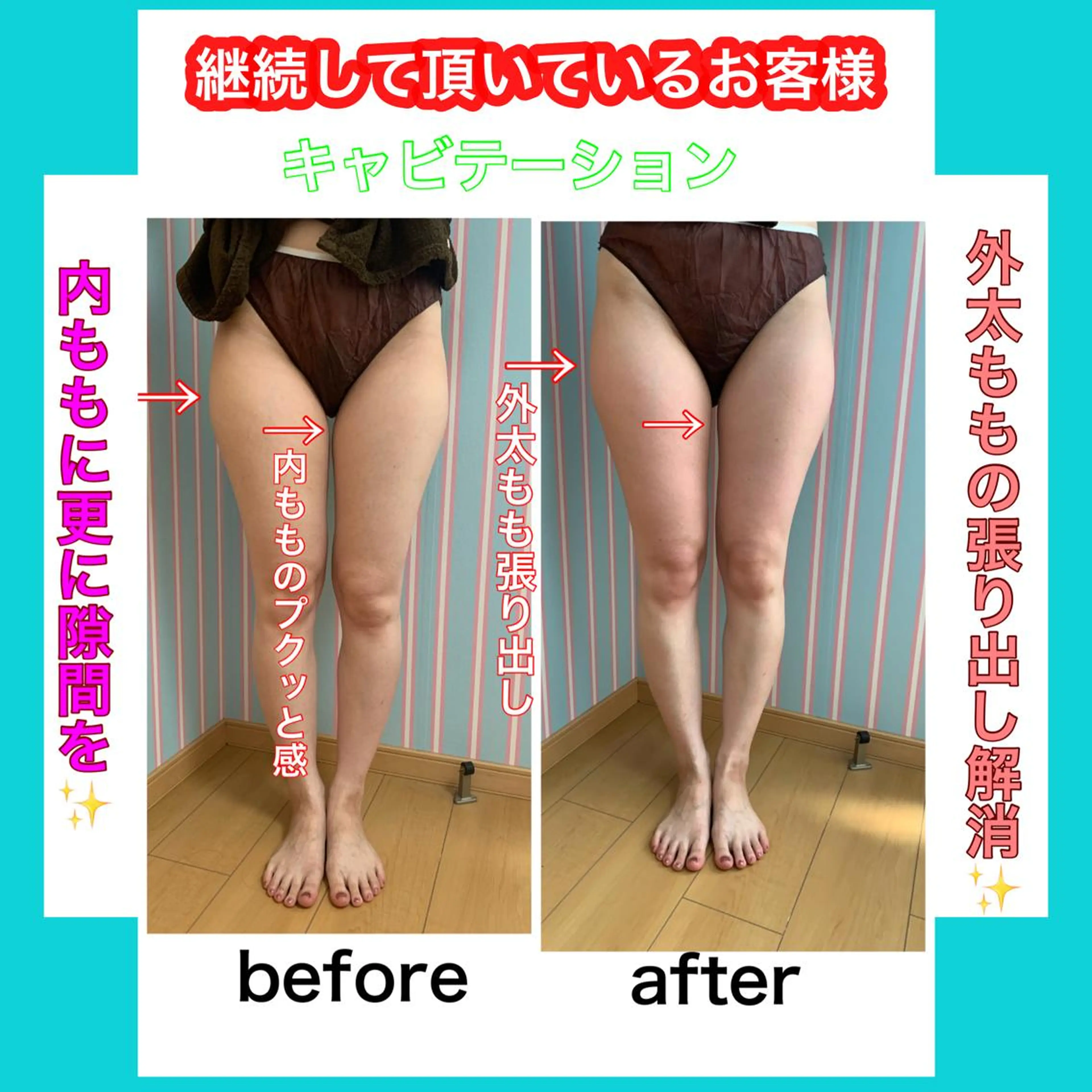 キャビテーション】を 継続して頂いているお客様 . . ボディー