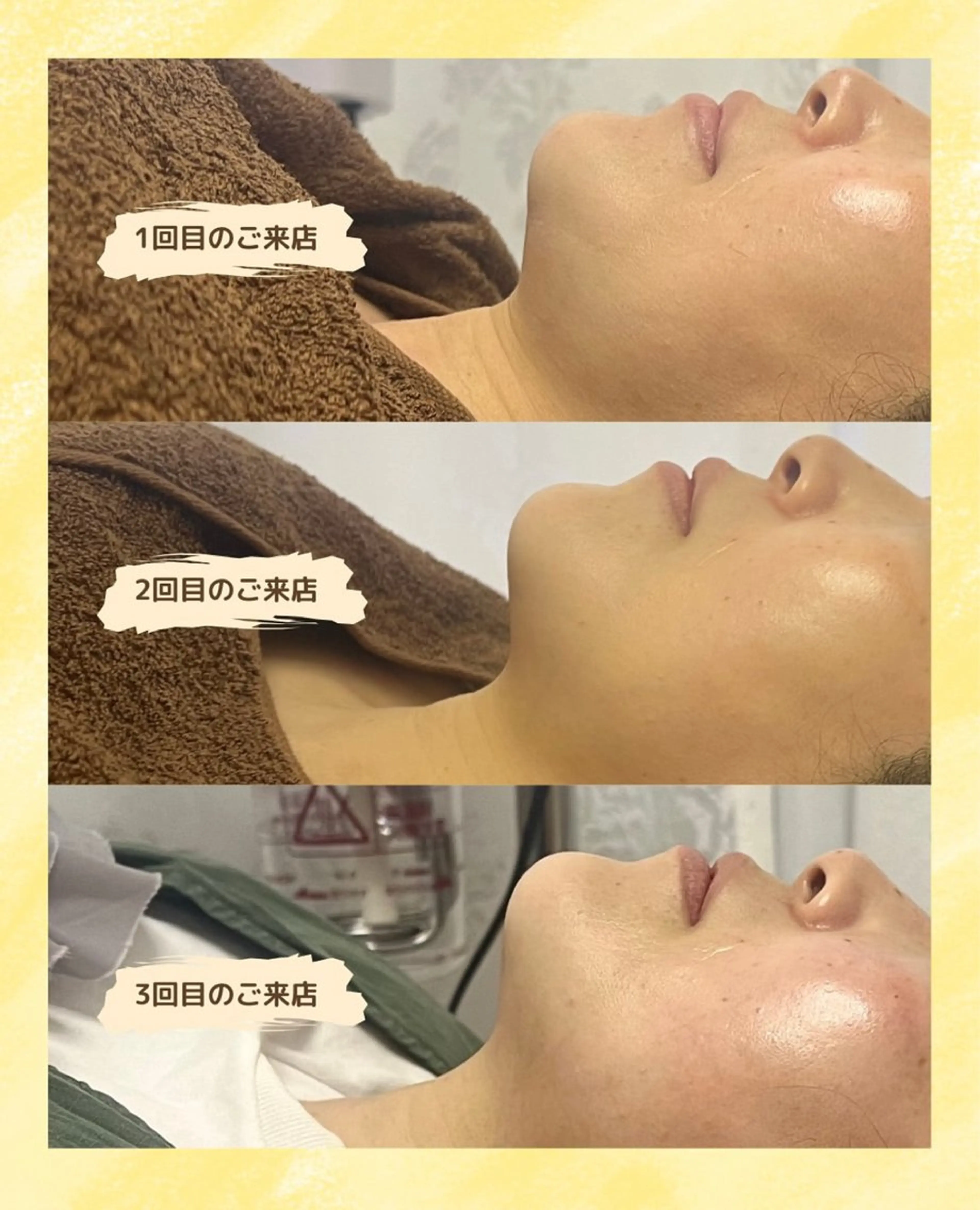 看護師が施術する ナスサロ/Emi🪽のエステ・リラクイメージ