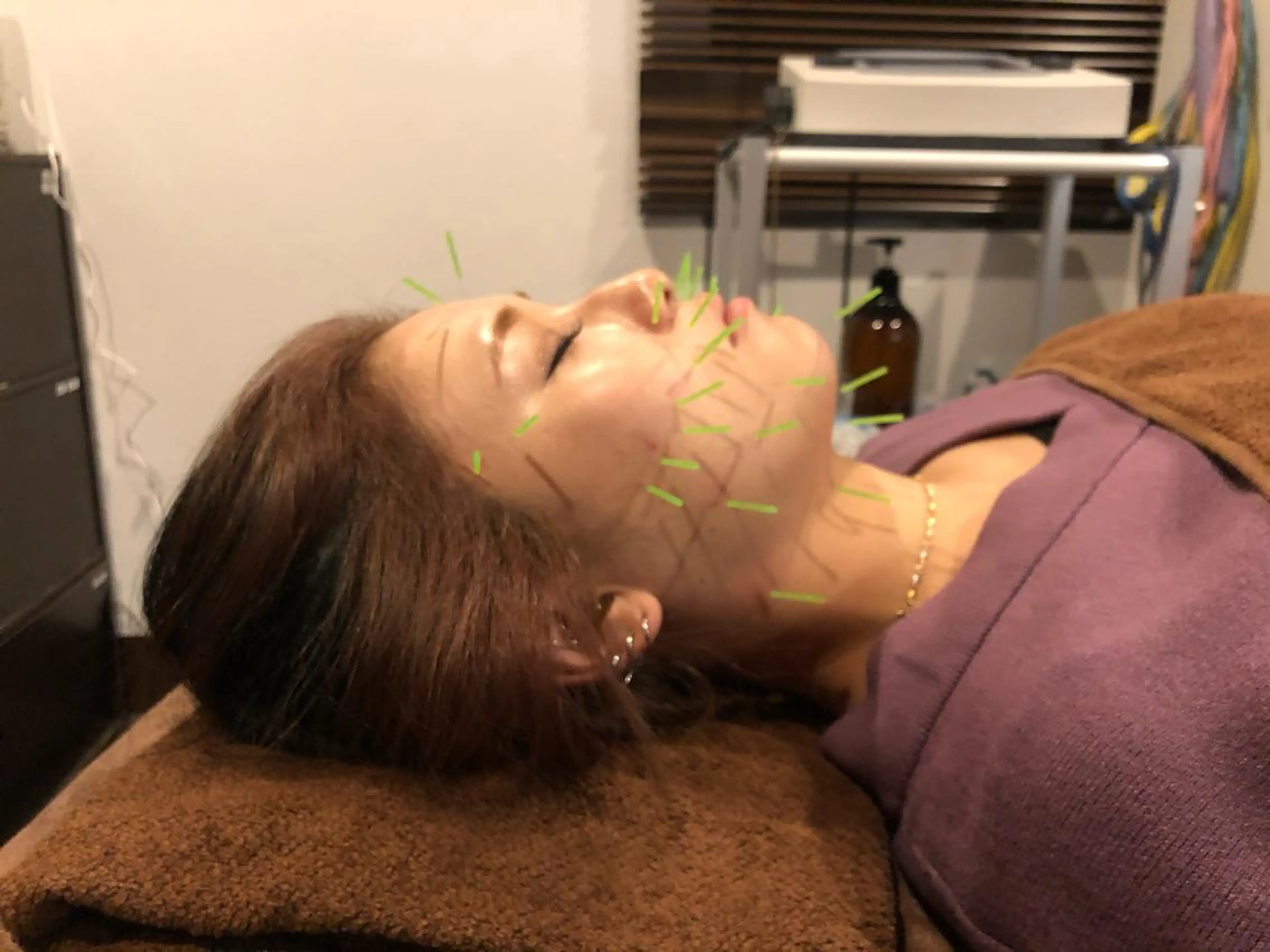 エステ リラク 美容鍼灸サロン LOMIHARIのエステ・リラクイメージ