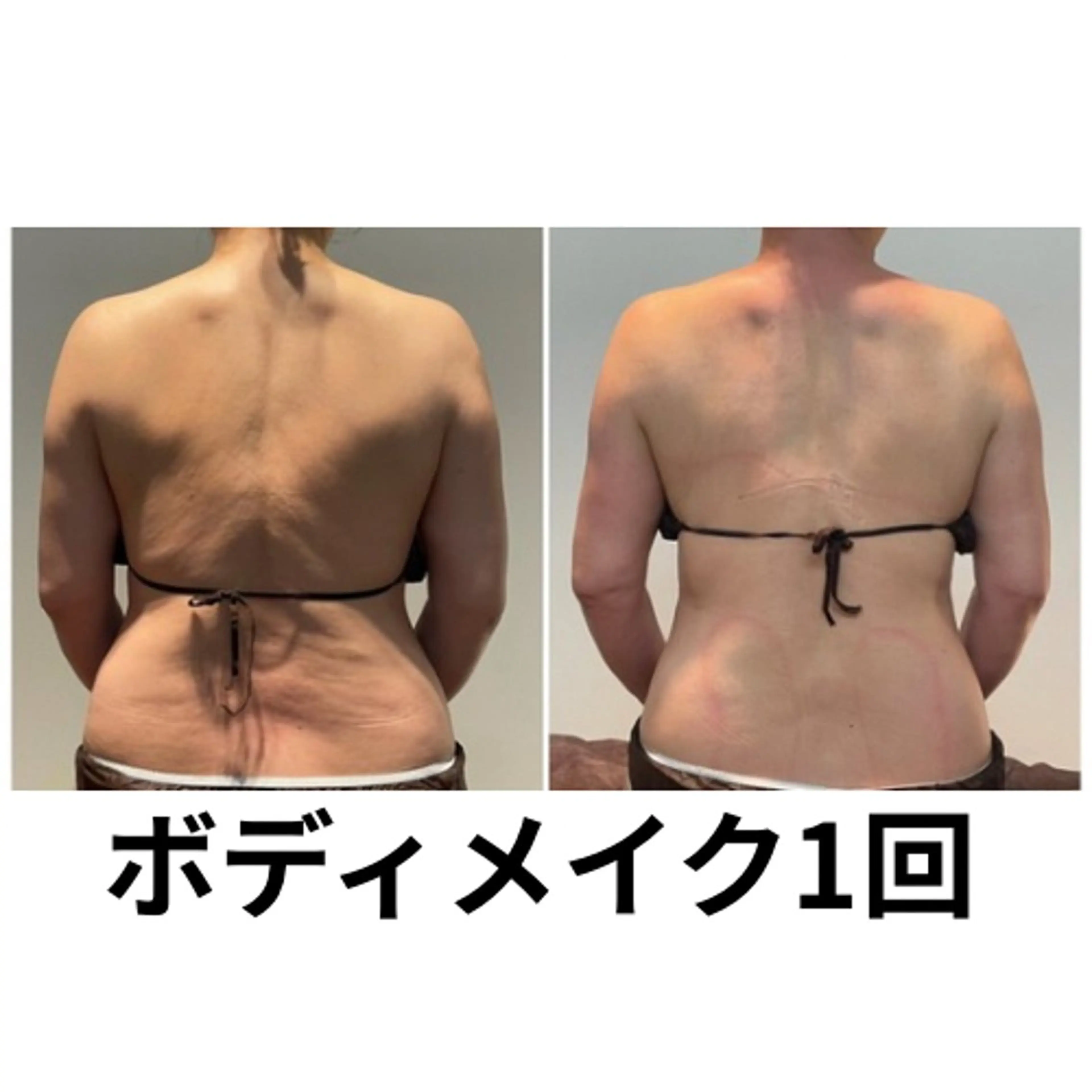 エステ 筋膜リリースエステ ESENCIAのエステ・リラクイメージ