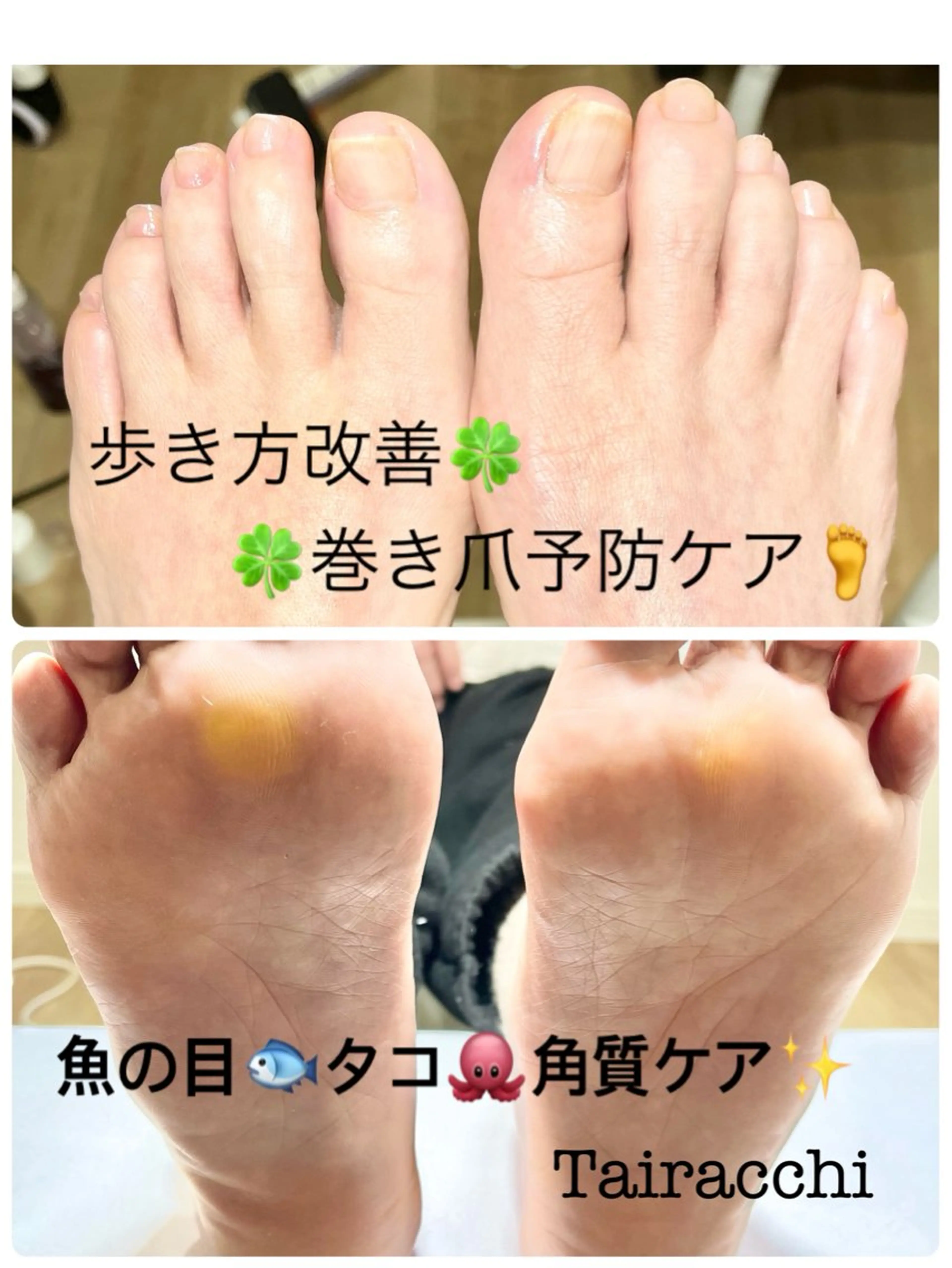 ネイル フットネイル フットネイル Tairacchi ﾀｲﾗｯﾁのネイルデザイン